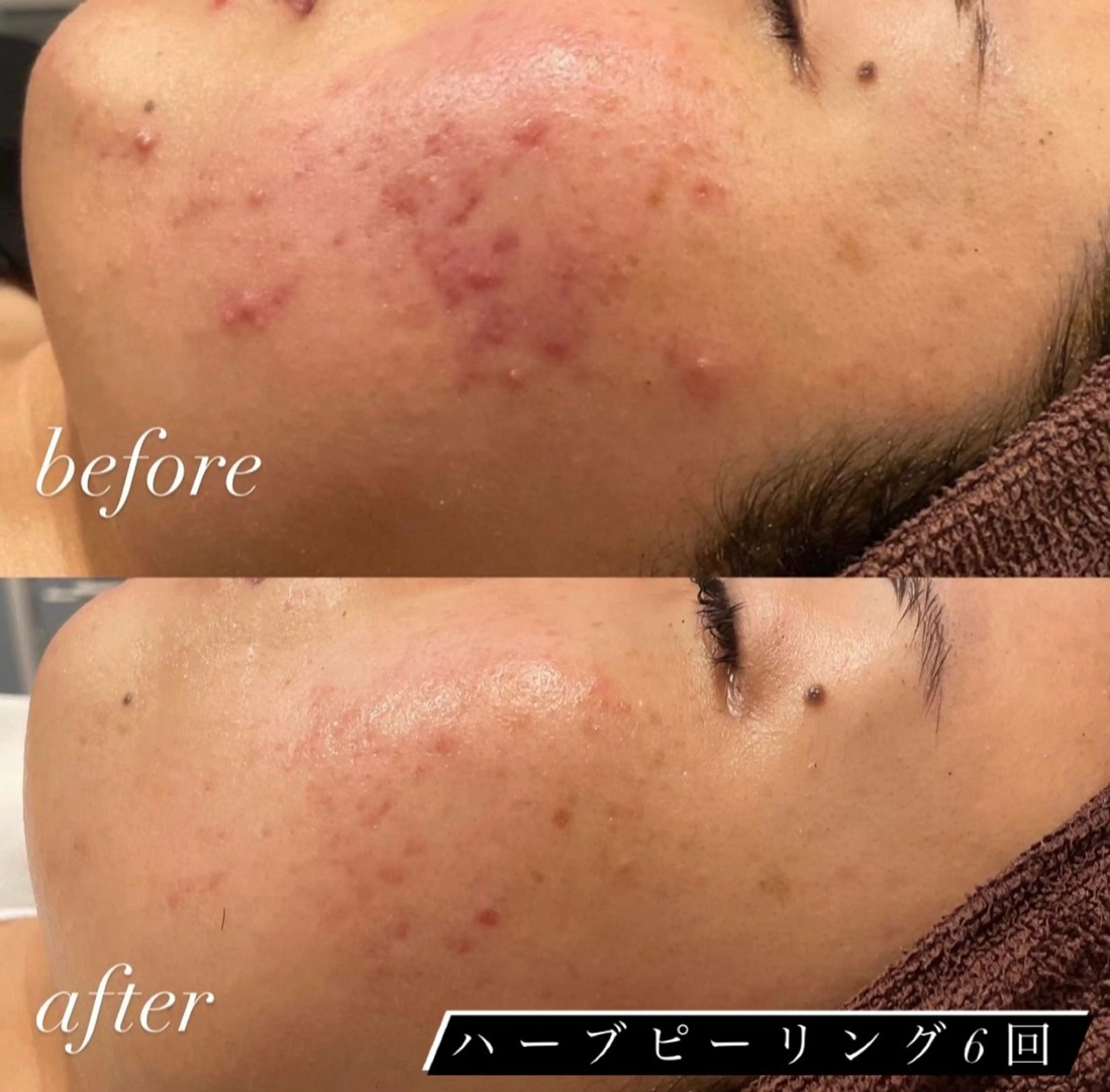 鍼グリッター所属・長尾 美鈴のその他イメージ