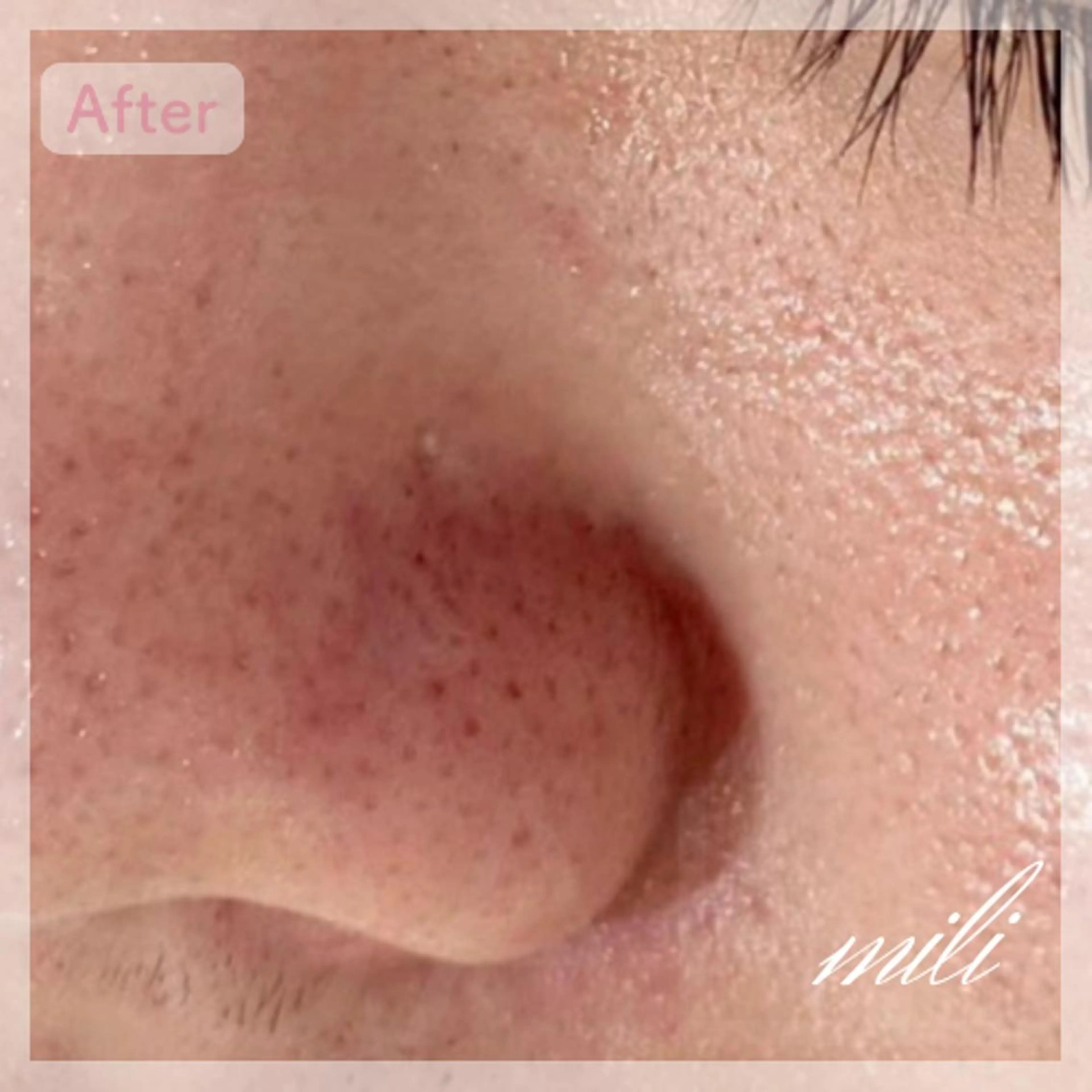 【毛穴ケア専門店✨】 mili 須藤歩華のエステ・リラクイメージ