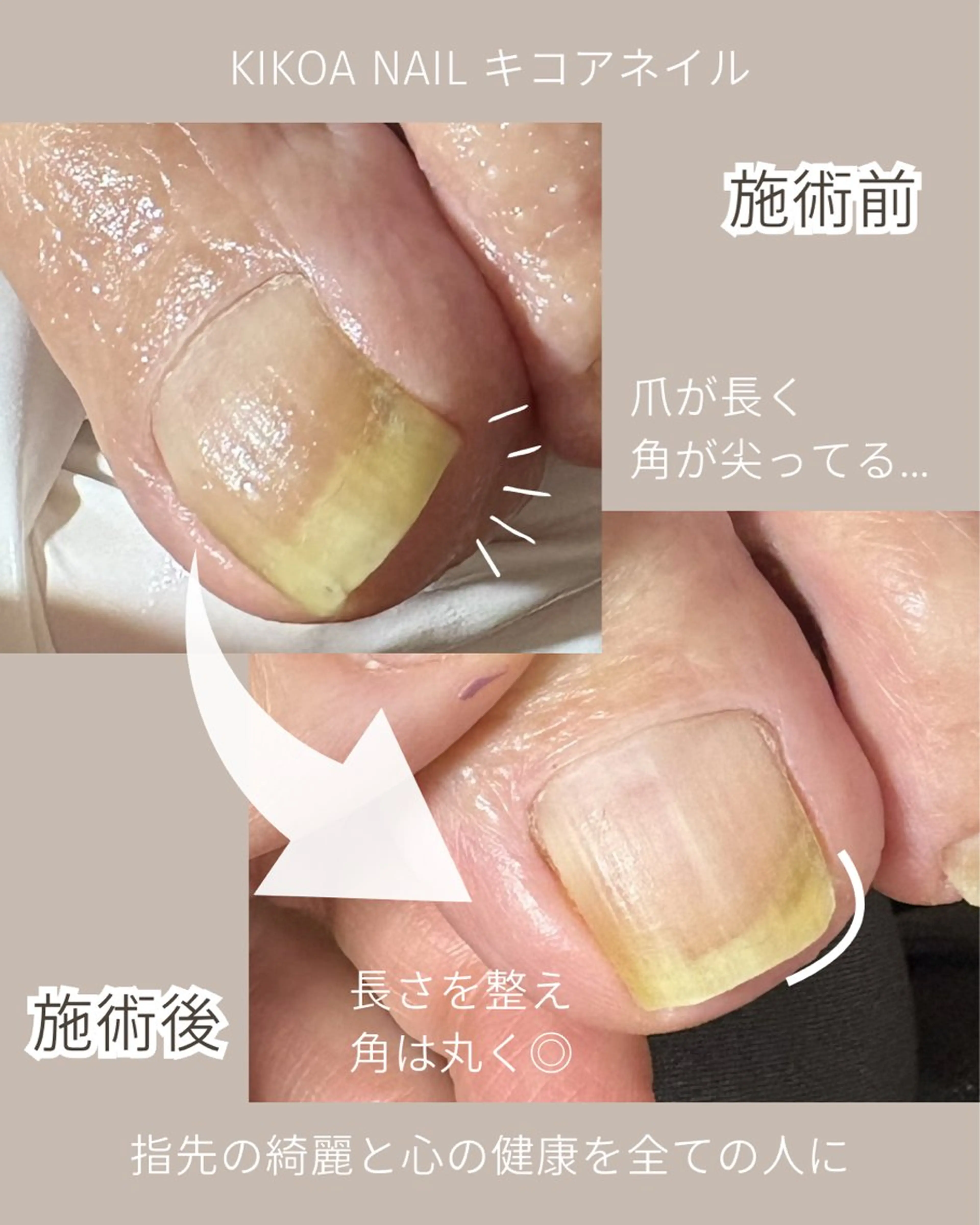 ネイル KIKOA NAIL キコアネイルのネイルデザイン