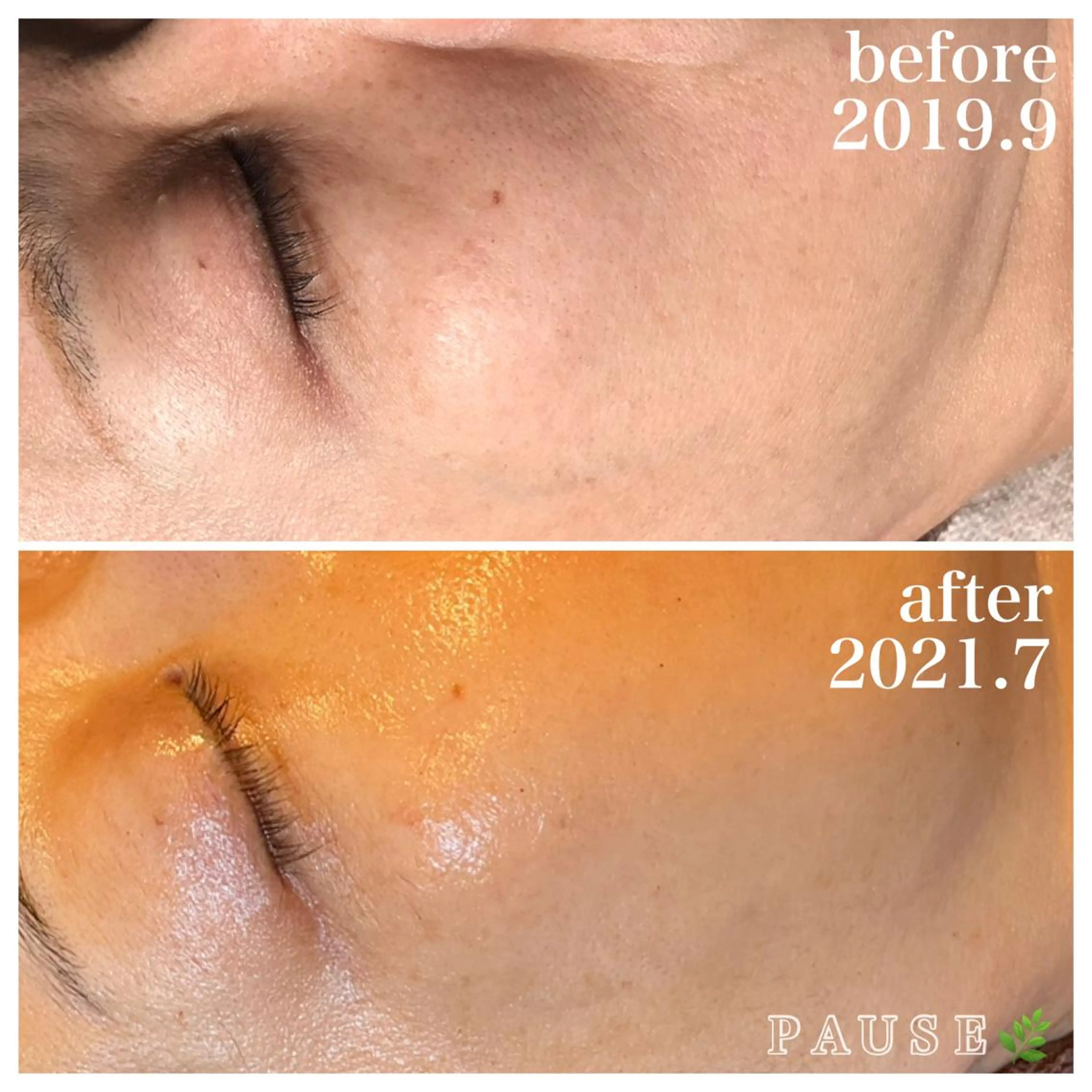 エステ 浜野 恵美のエステ・リラクイメージ