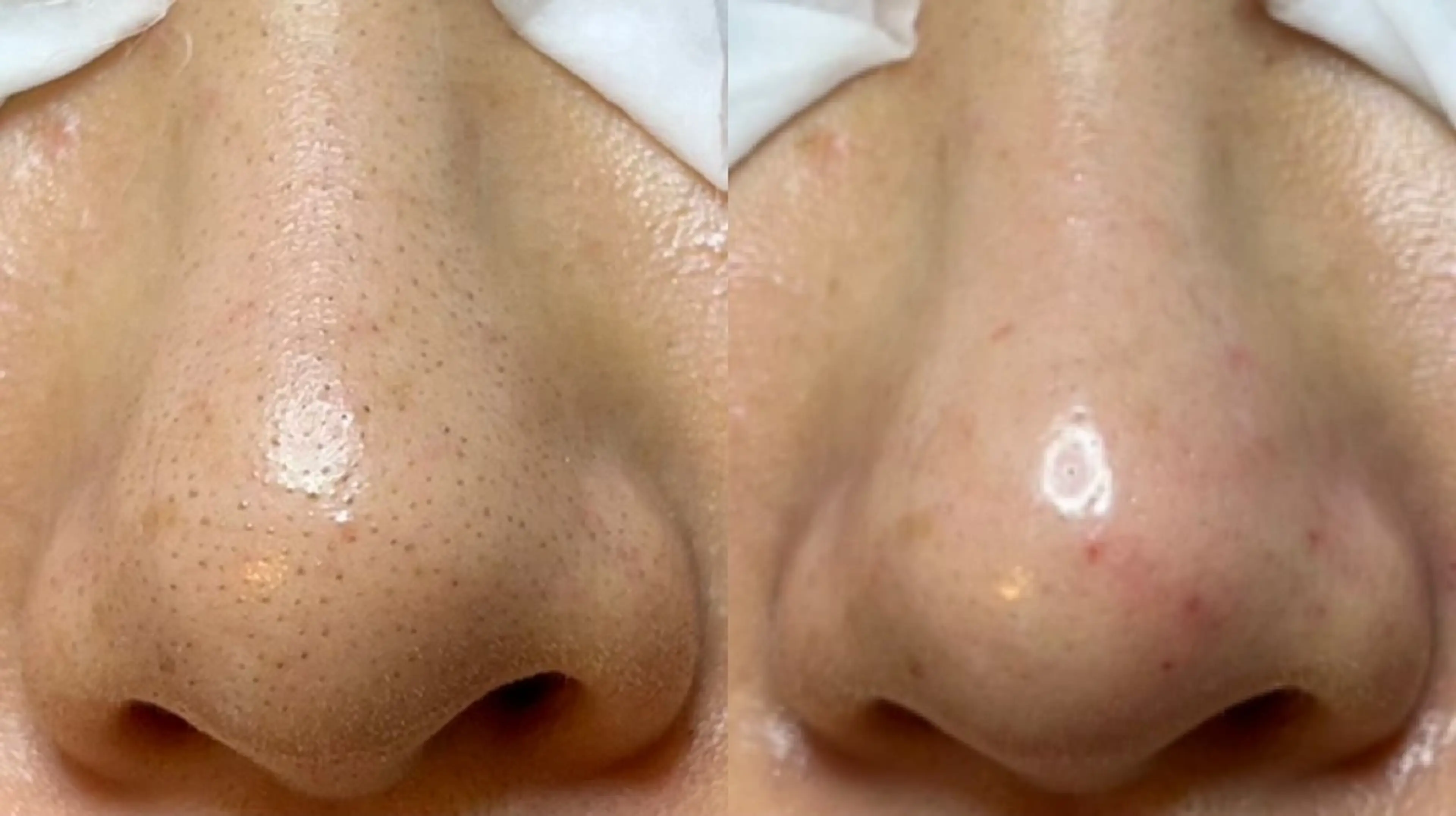 Lipula リプラ所属・毛穴ツヤ肌専門    Lipulaのエステ・リラクイメージ