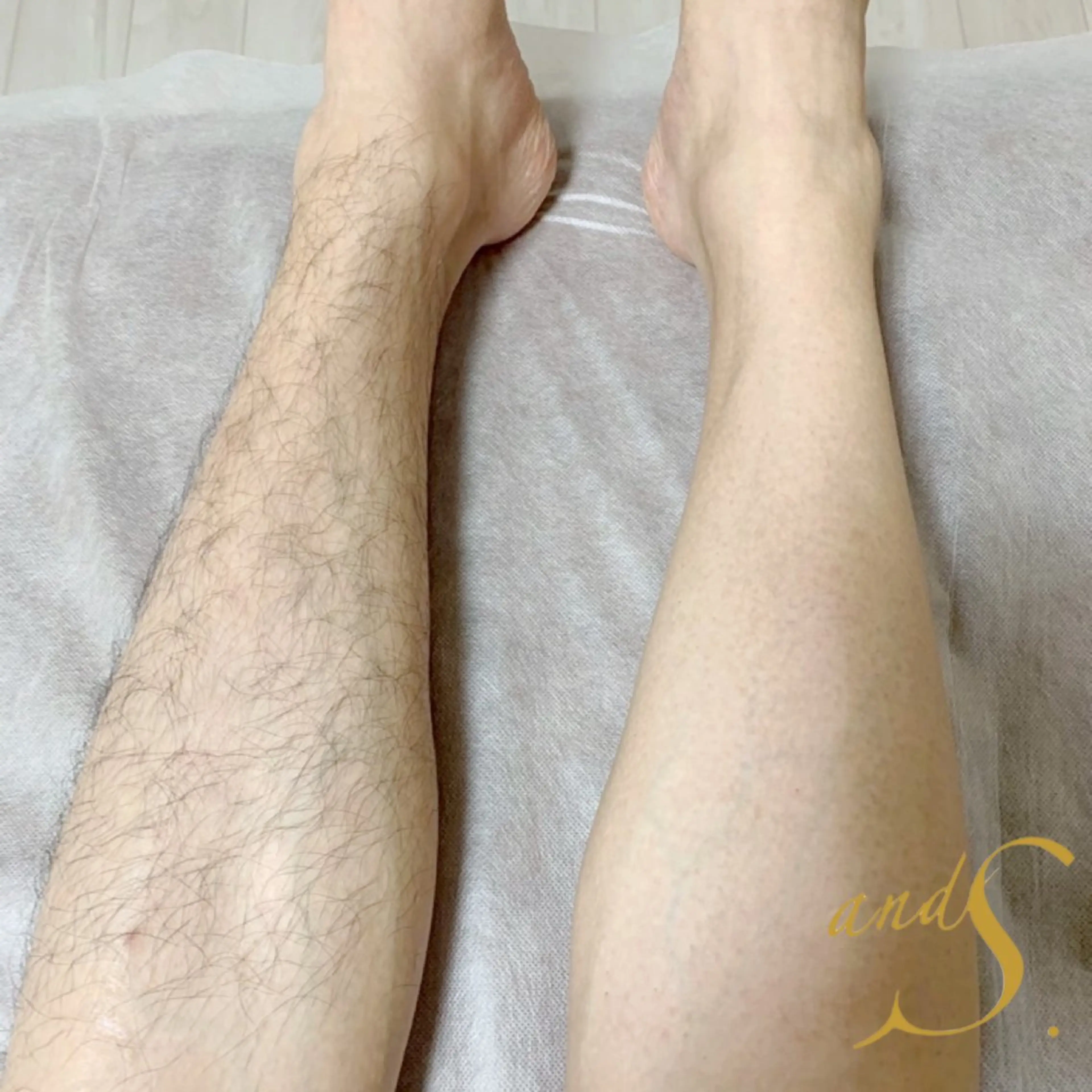 メンズ 脱毛 🌸🧡六本木 脱毛しずか🧡🫧の眉毛・アイブロウイメージ