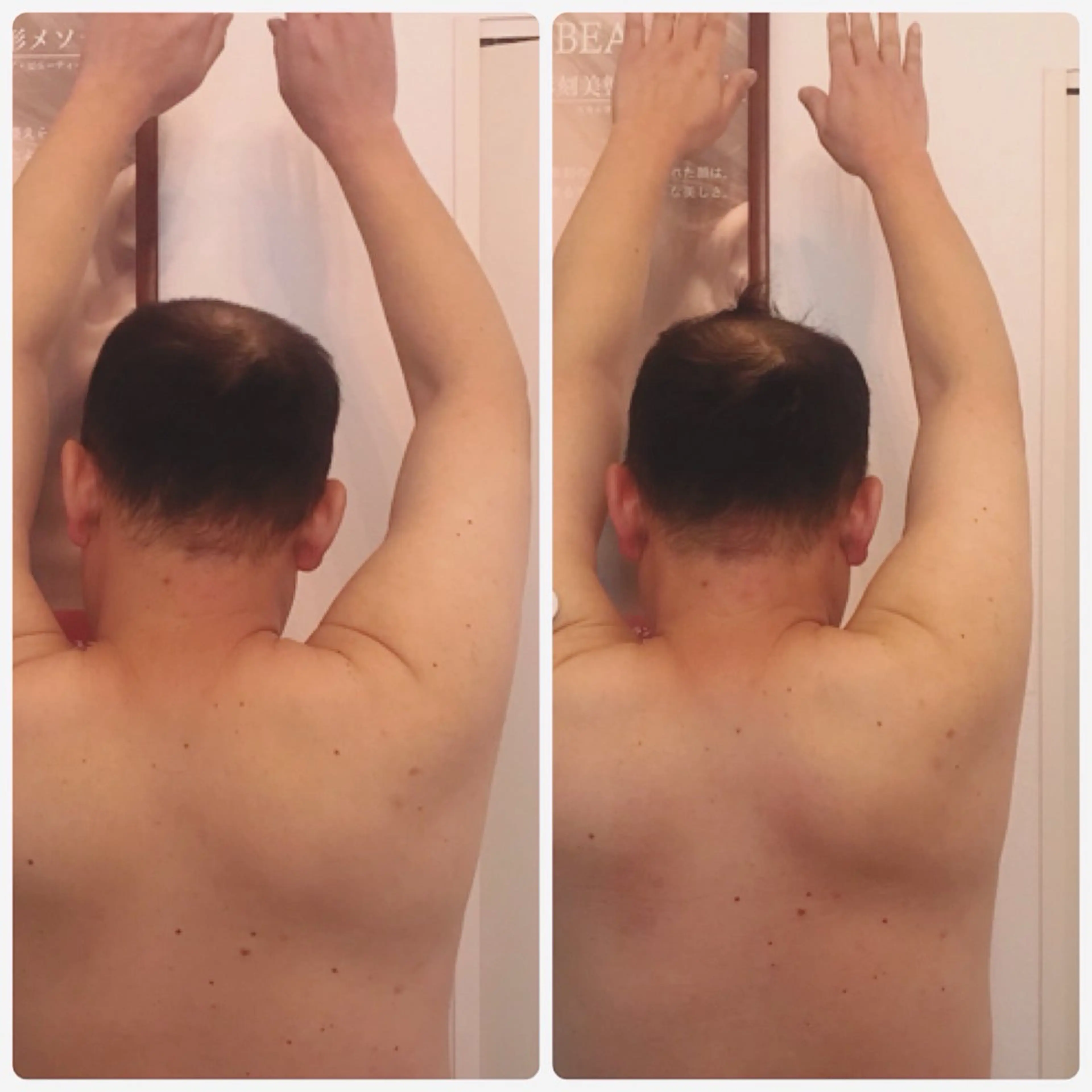 メンズ 小顔バランス unicaのエステ・リラクイメージ