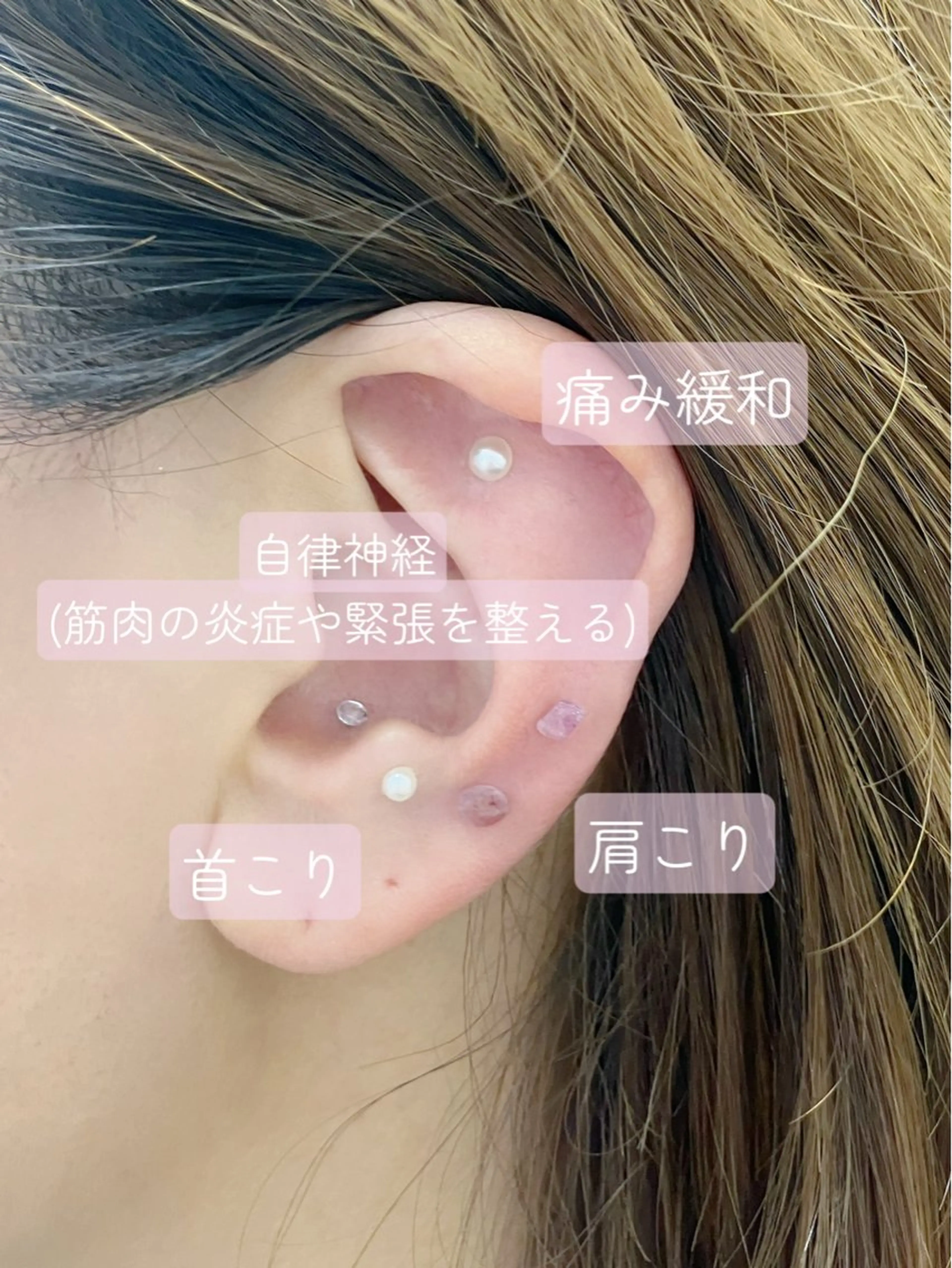 その他 S LOUNGE NAIL(エステ・耳ツボ)所属・耳つぼ💎エステ kimiのその他イメージ