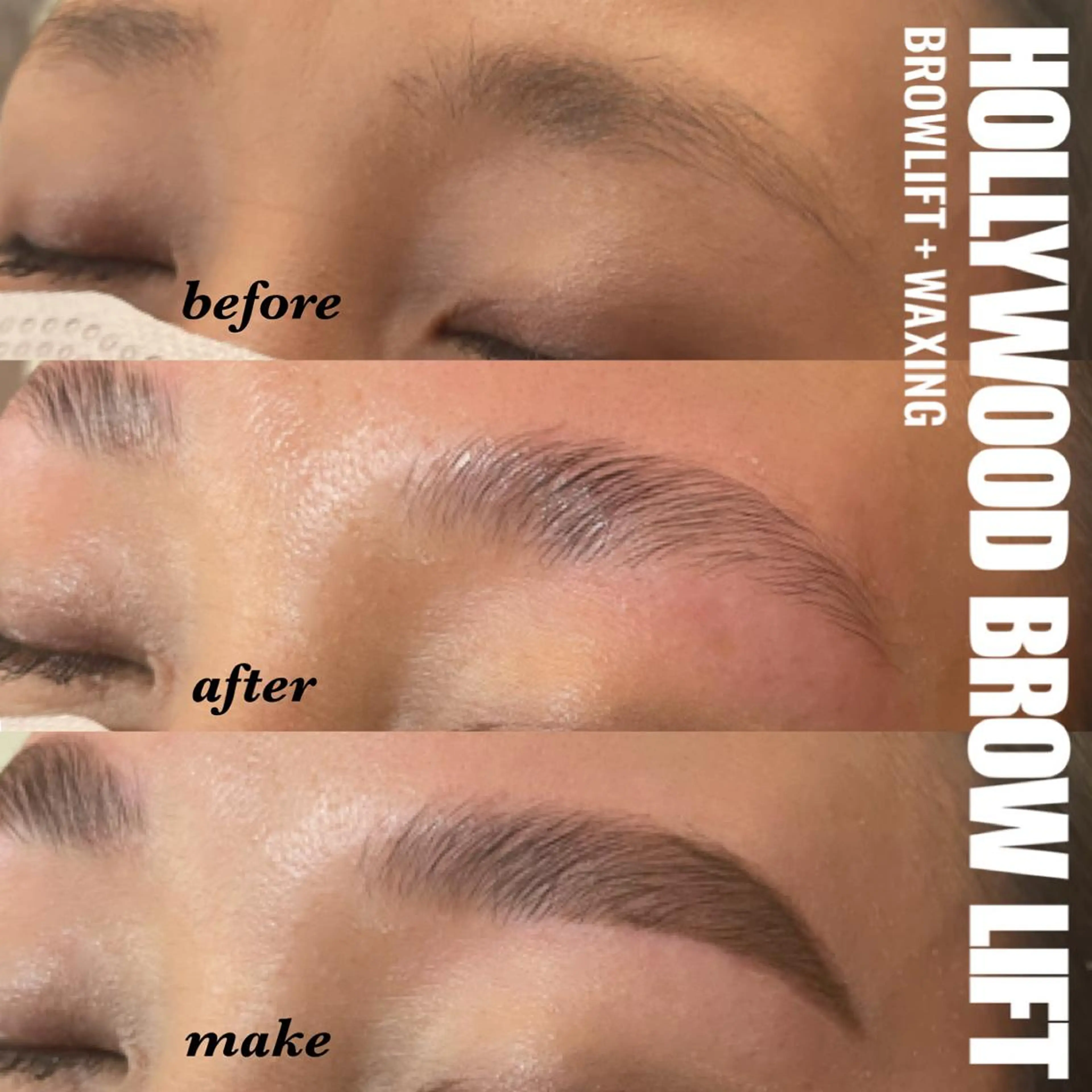 HOLLYWOOD BROW LIFTの写真