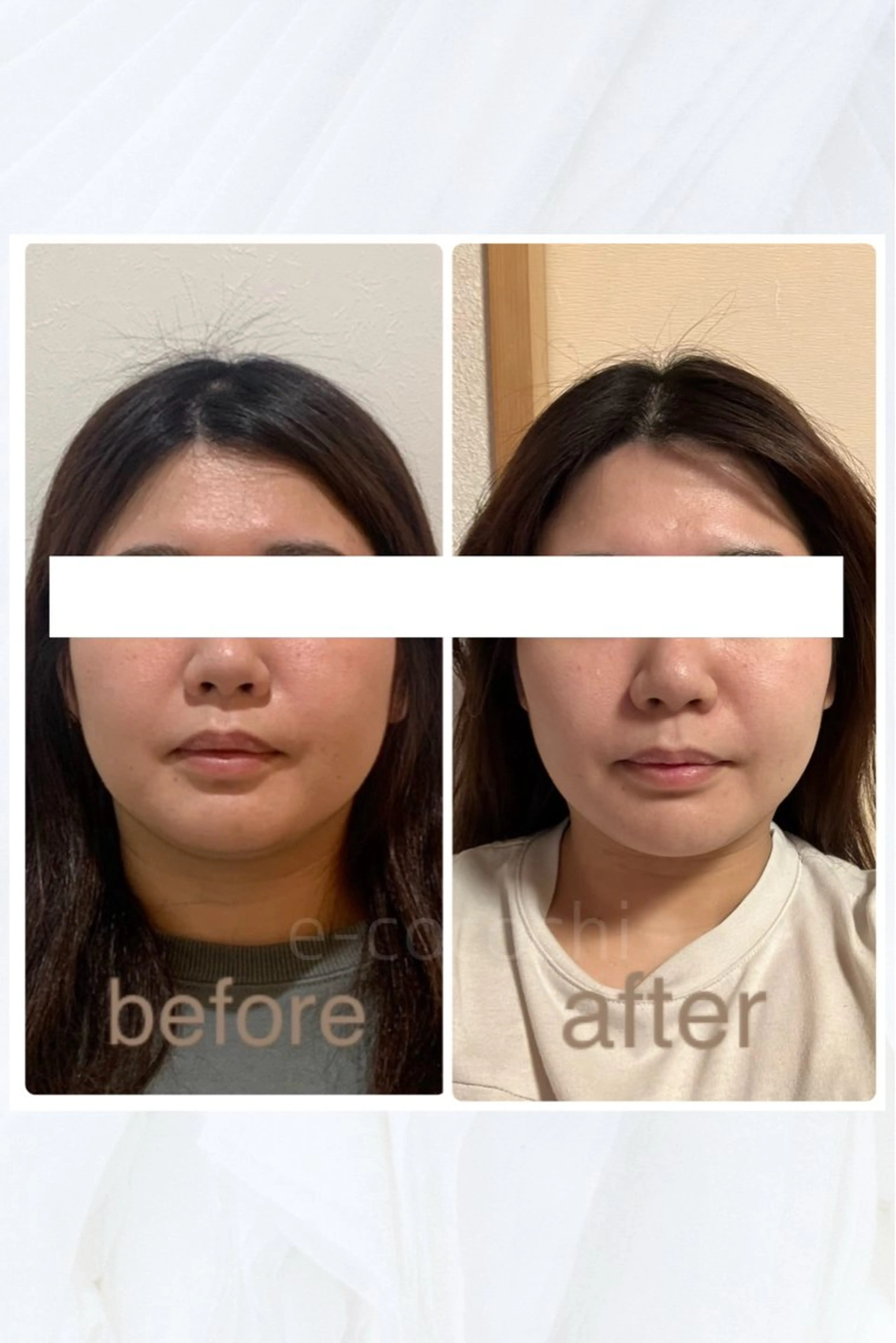 エステ リラク 小顔と ヘッドスパのお店のエステ・リラクイメージ