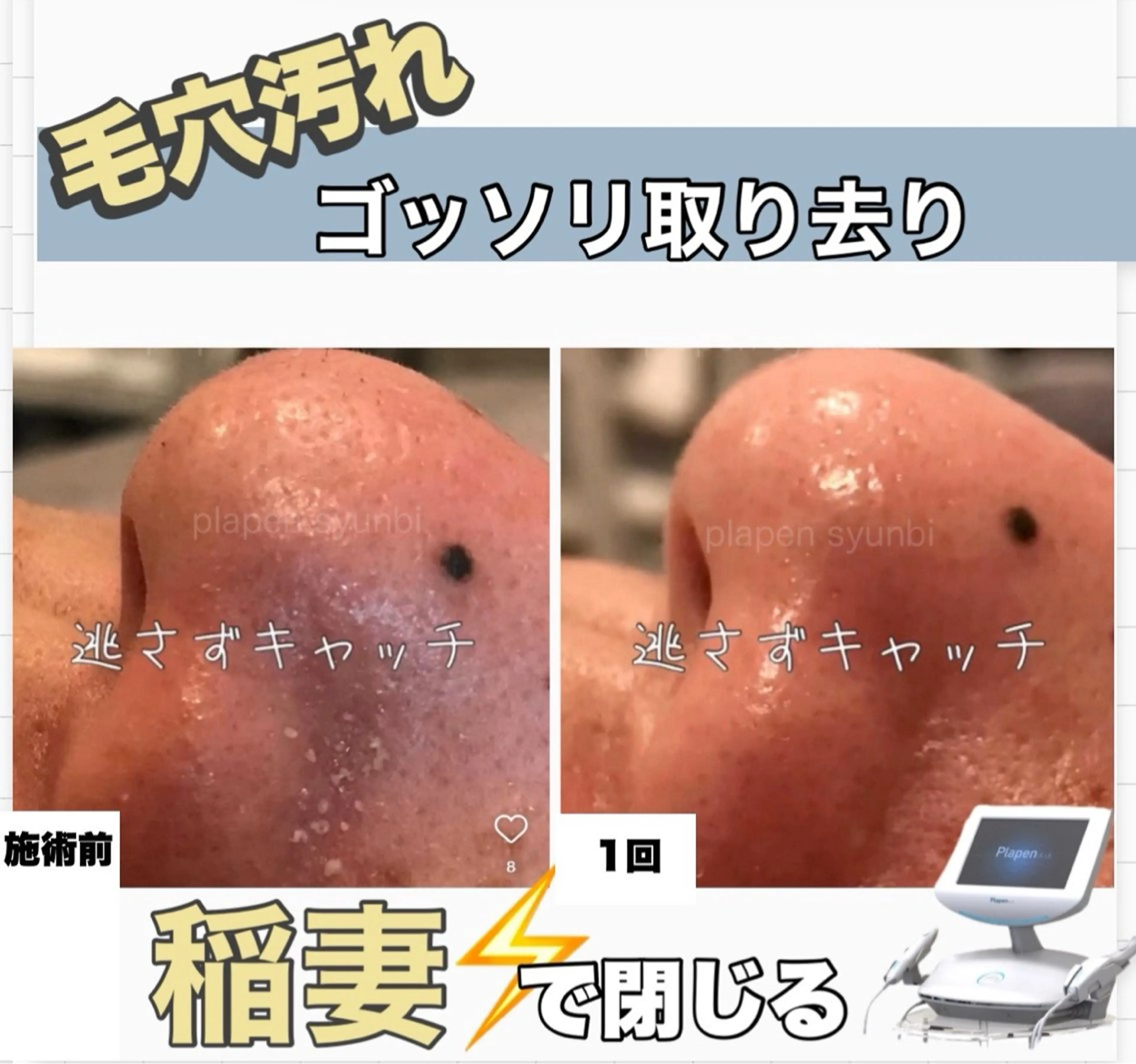 エステ Lumiere despoir所属・Lumiere despoirのエステ・リラクイメージ