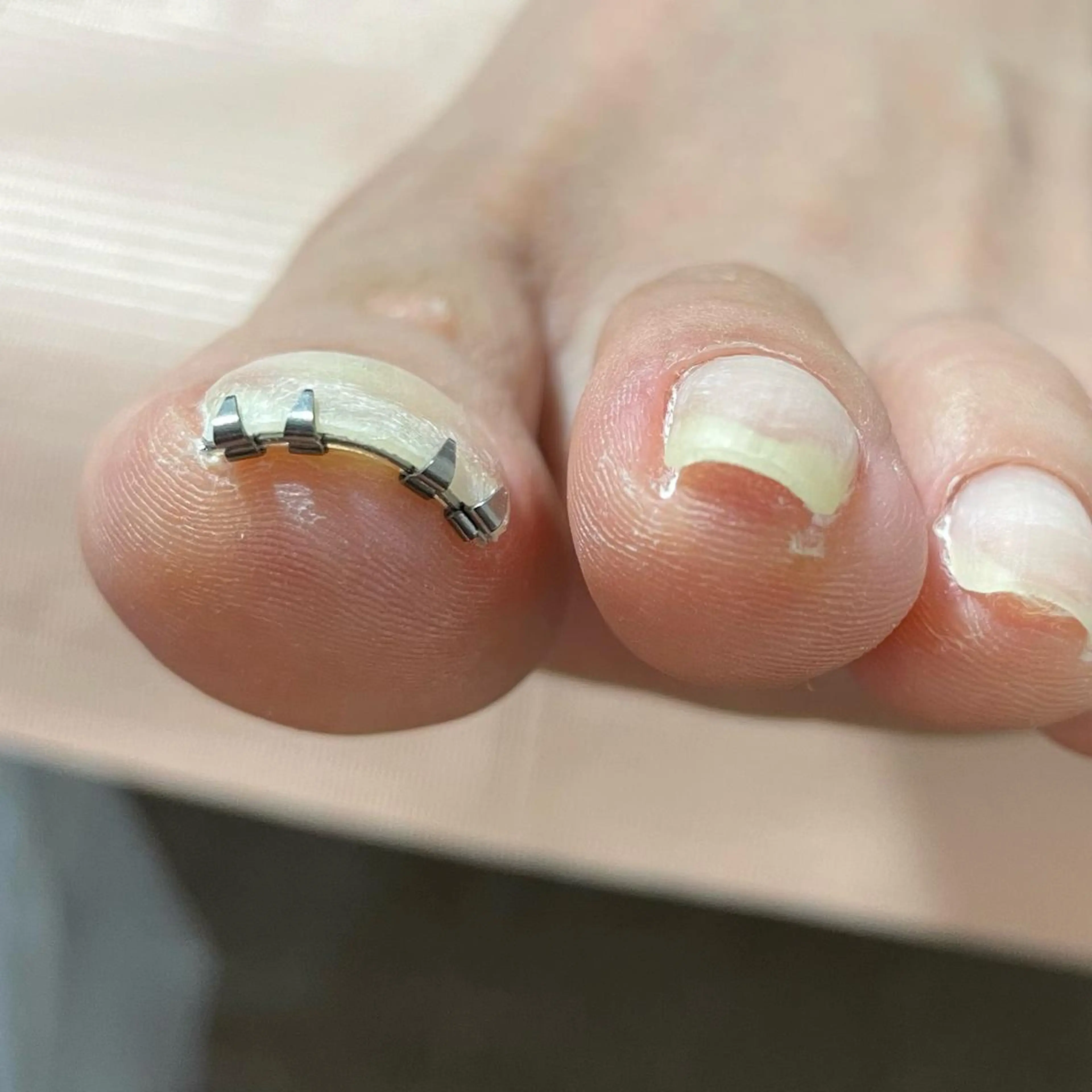 ネイル nail salon ワンミリオンのネイルデザイン