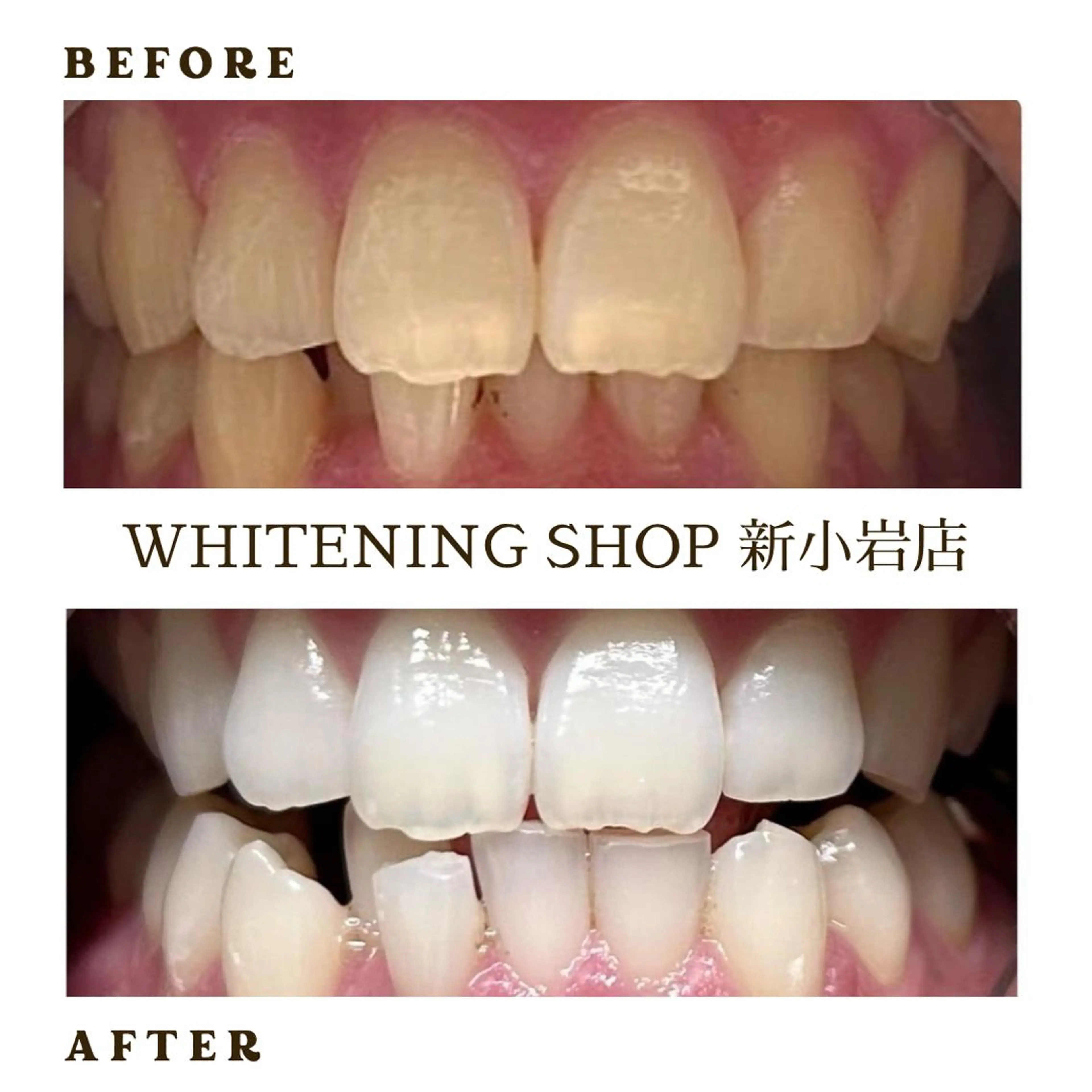 メンズ キッズ 学生（メンズ向け） その他 ホワイトニング ショップ新小岩店のその他イメージ