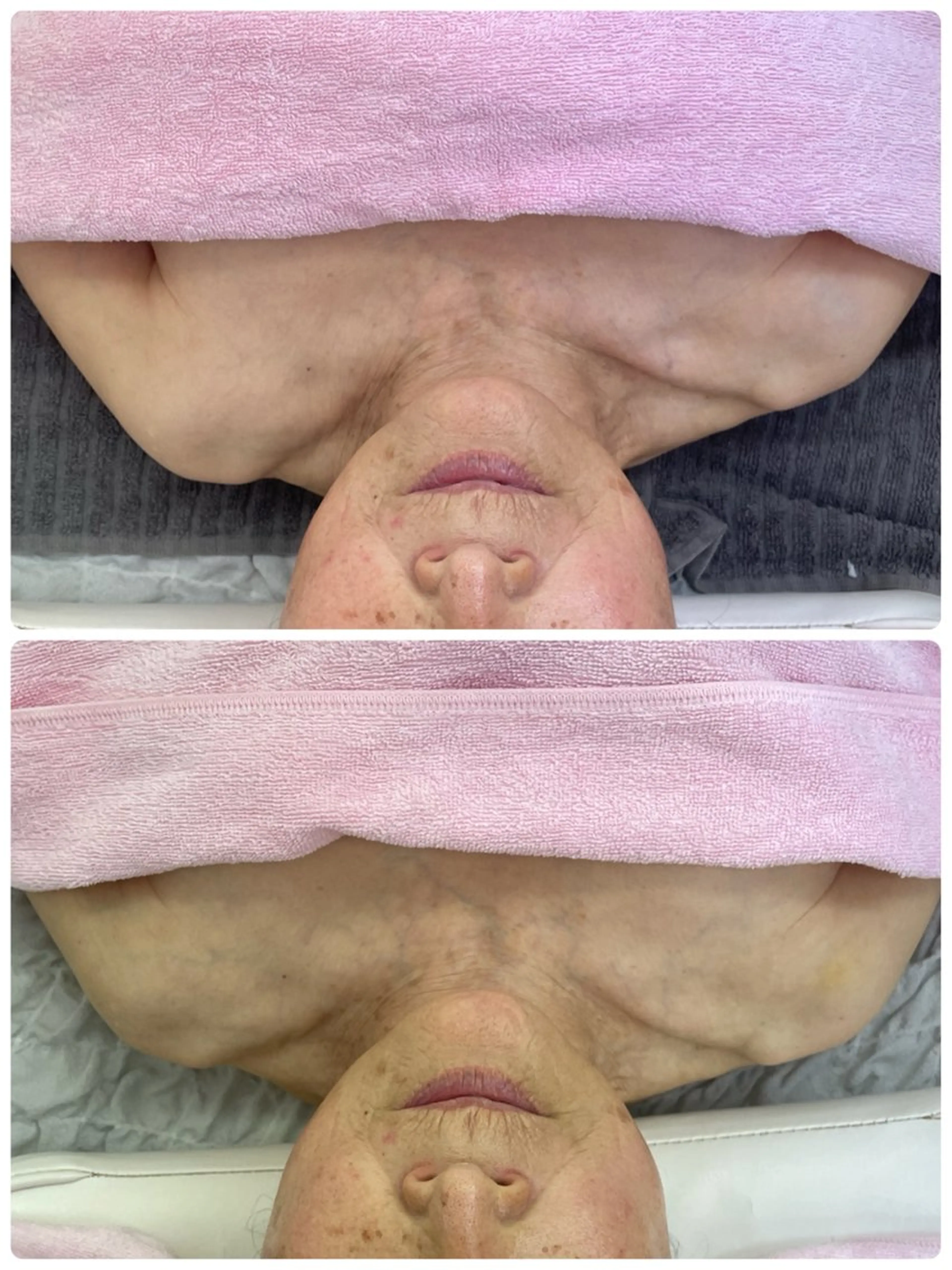 Salon Rion所属・Rion 野々村のエステ・リラクイメージ