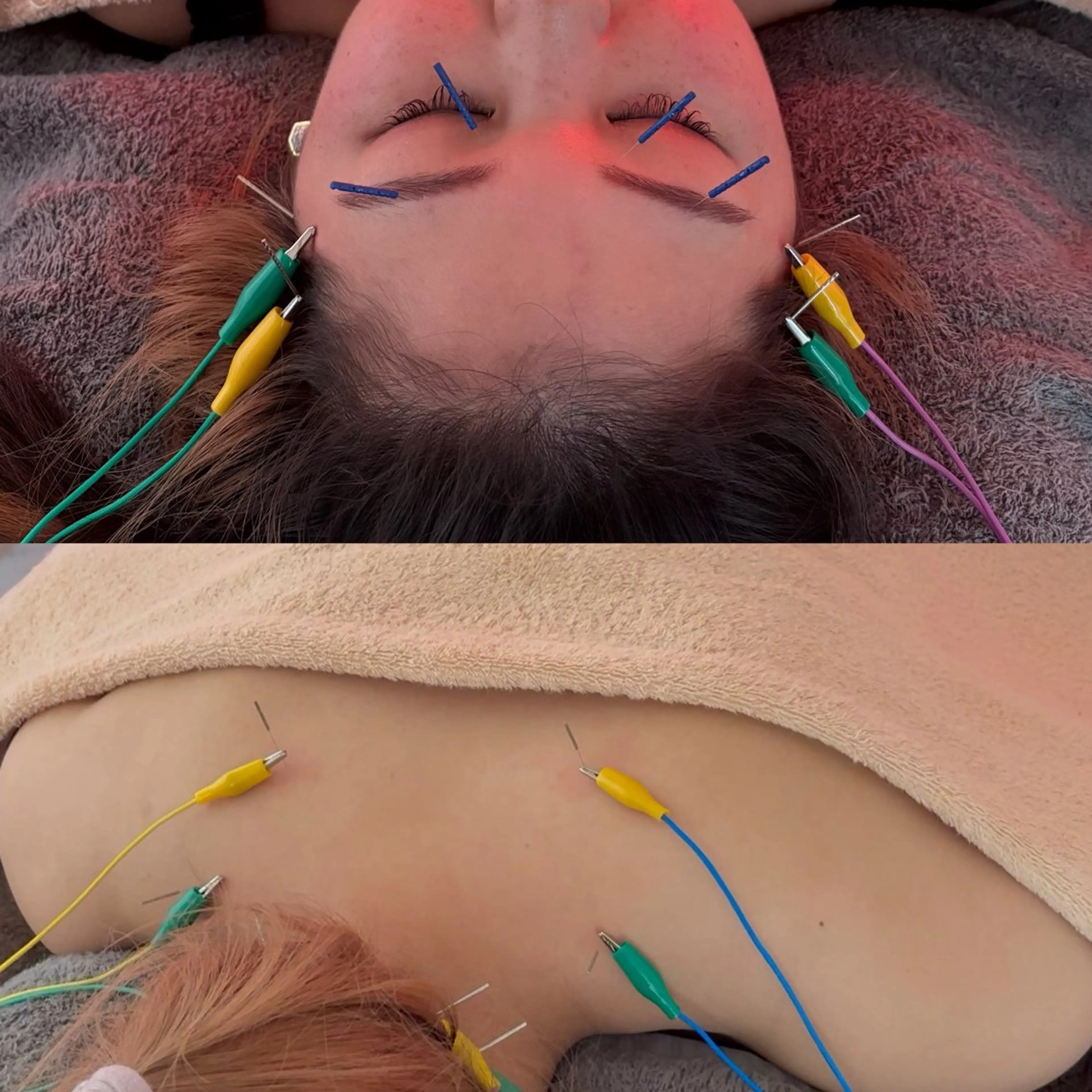 🌱平日限定🌱首肩凝り&眼精疲労セット✨通常¥8,250→平日45%OFFの¥4,600‼️の写真