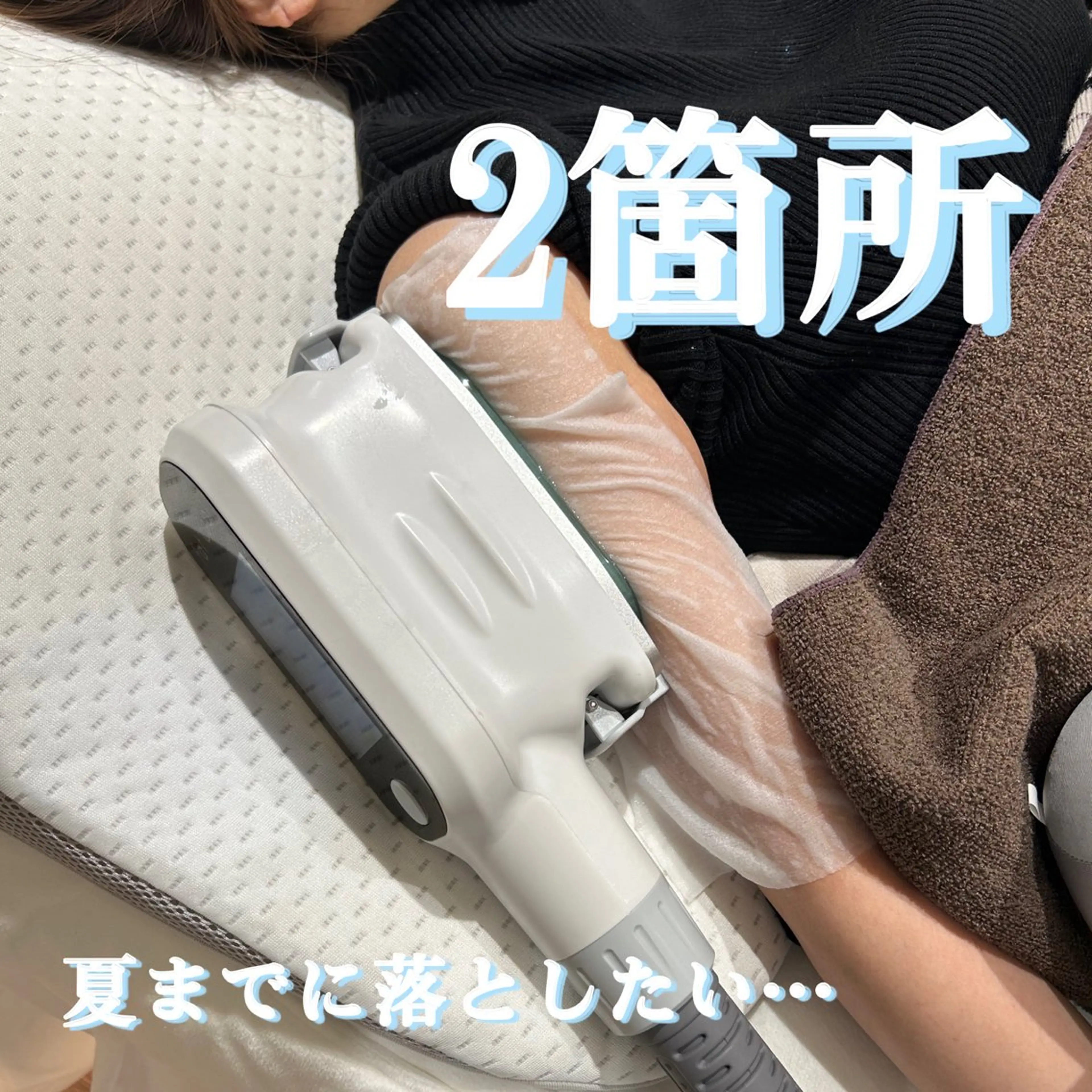 脂肪痩身〈二の腕〉初回体験2カップの写真