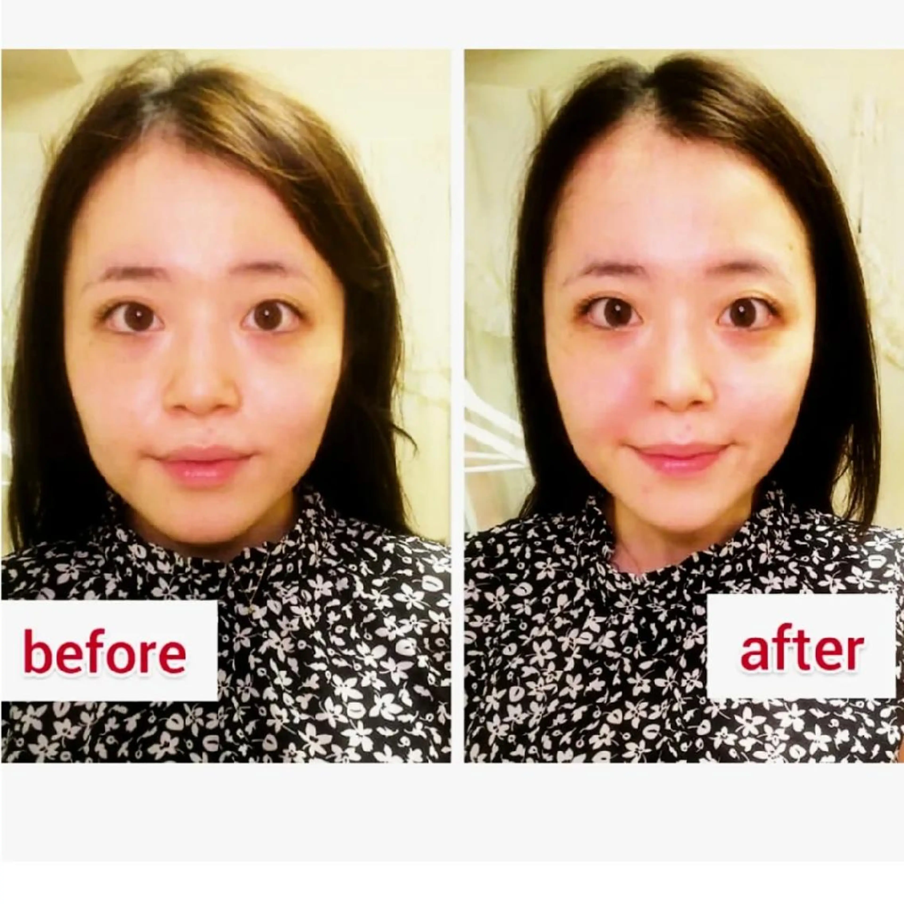 バスト&フェイシャル 専門店リラーシェのエステ・リラクイメージ