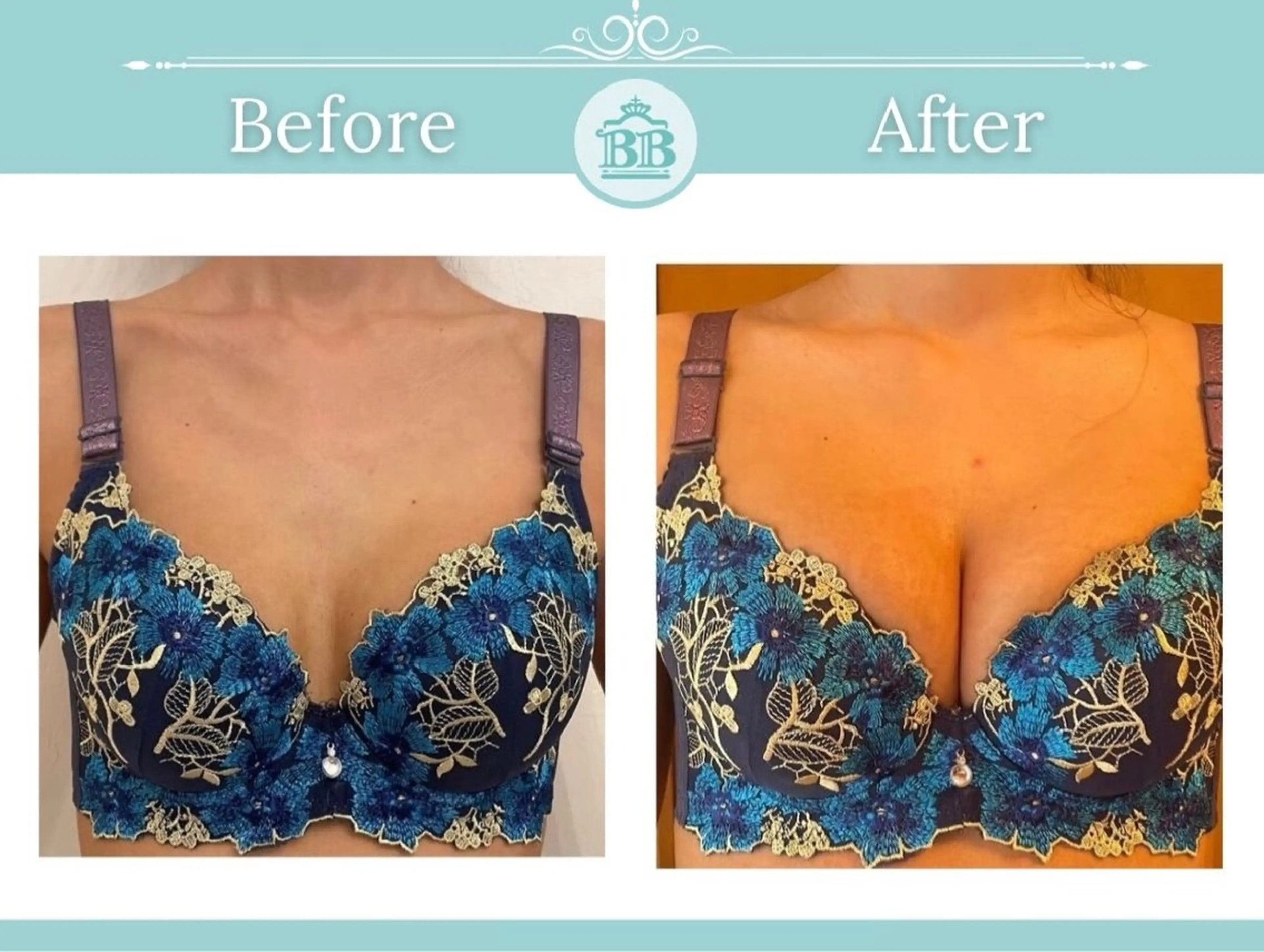 エステ 美人バスト本厚木店所属・美人バスト 本厚木店のエステ・リラクイメージ