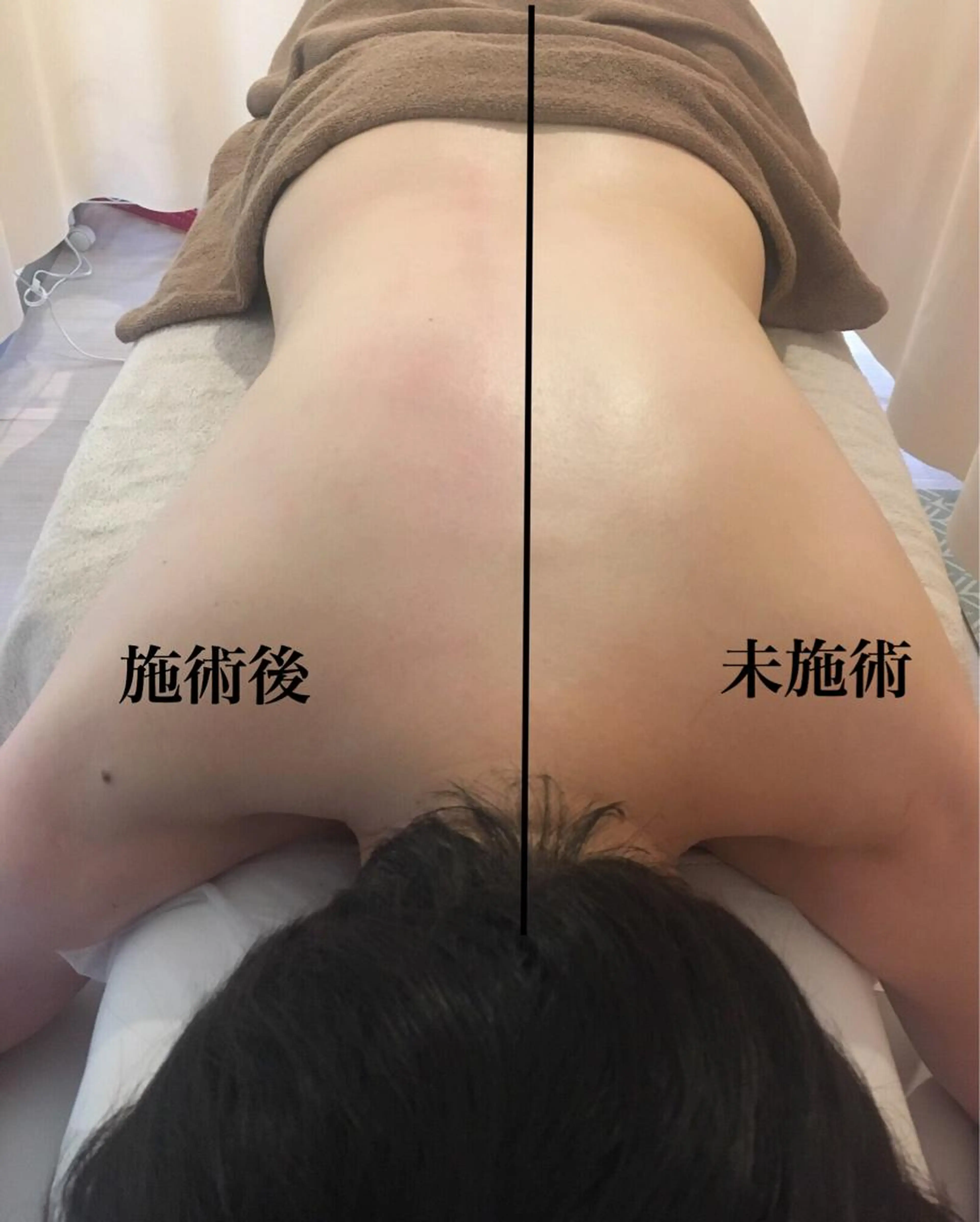 下半身・背中を華奢にする！強力デトックスコース 60分の写真