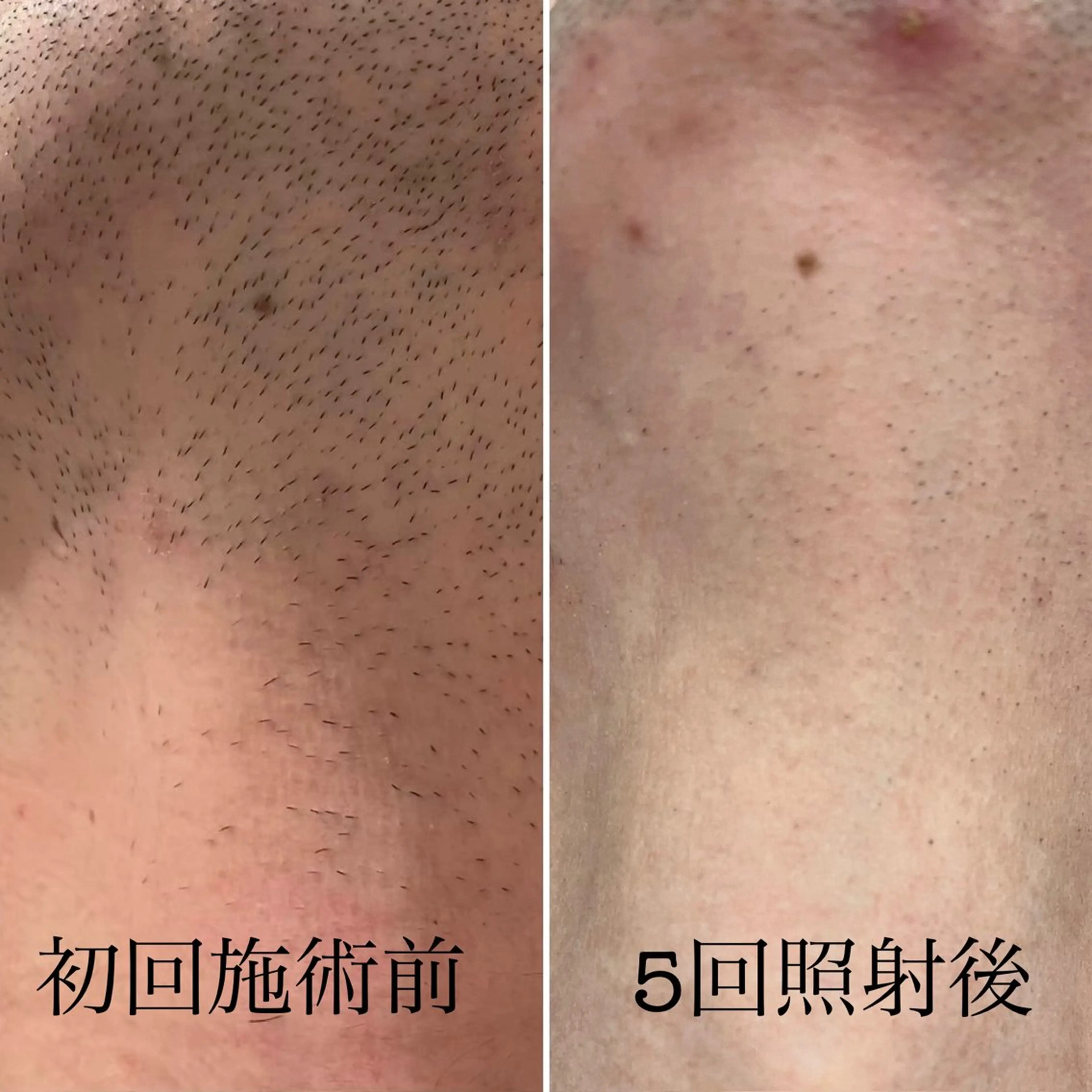 脱毛 Freyia Beautyのエステ・リラクイメージ