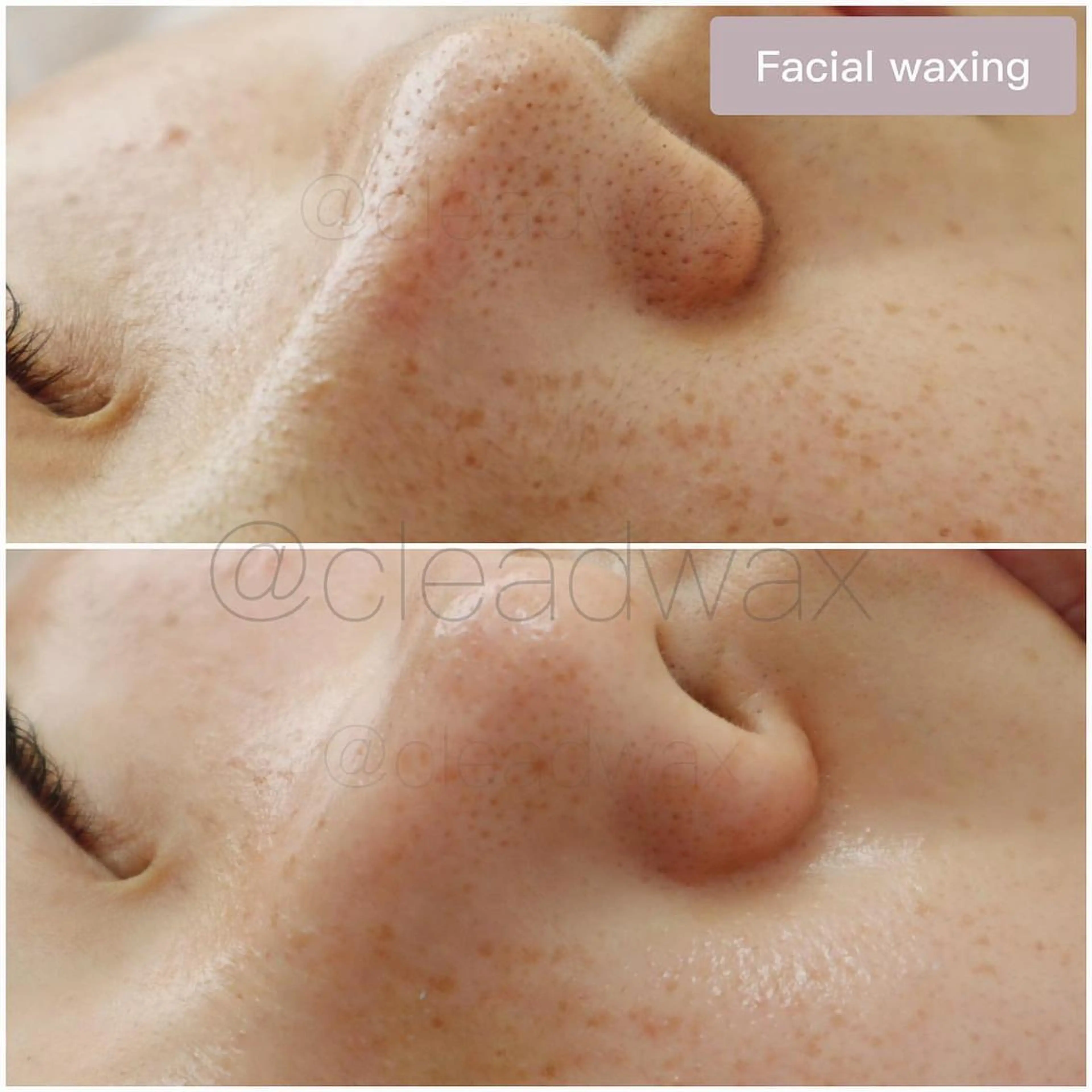 CLEAD 赤坂見附店のエステ・リラクイメージ