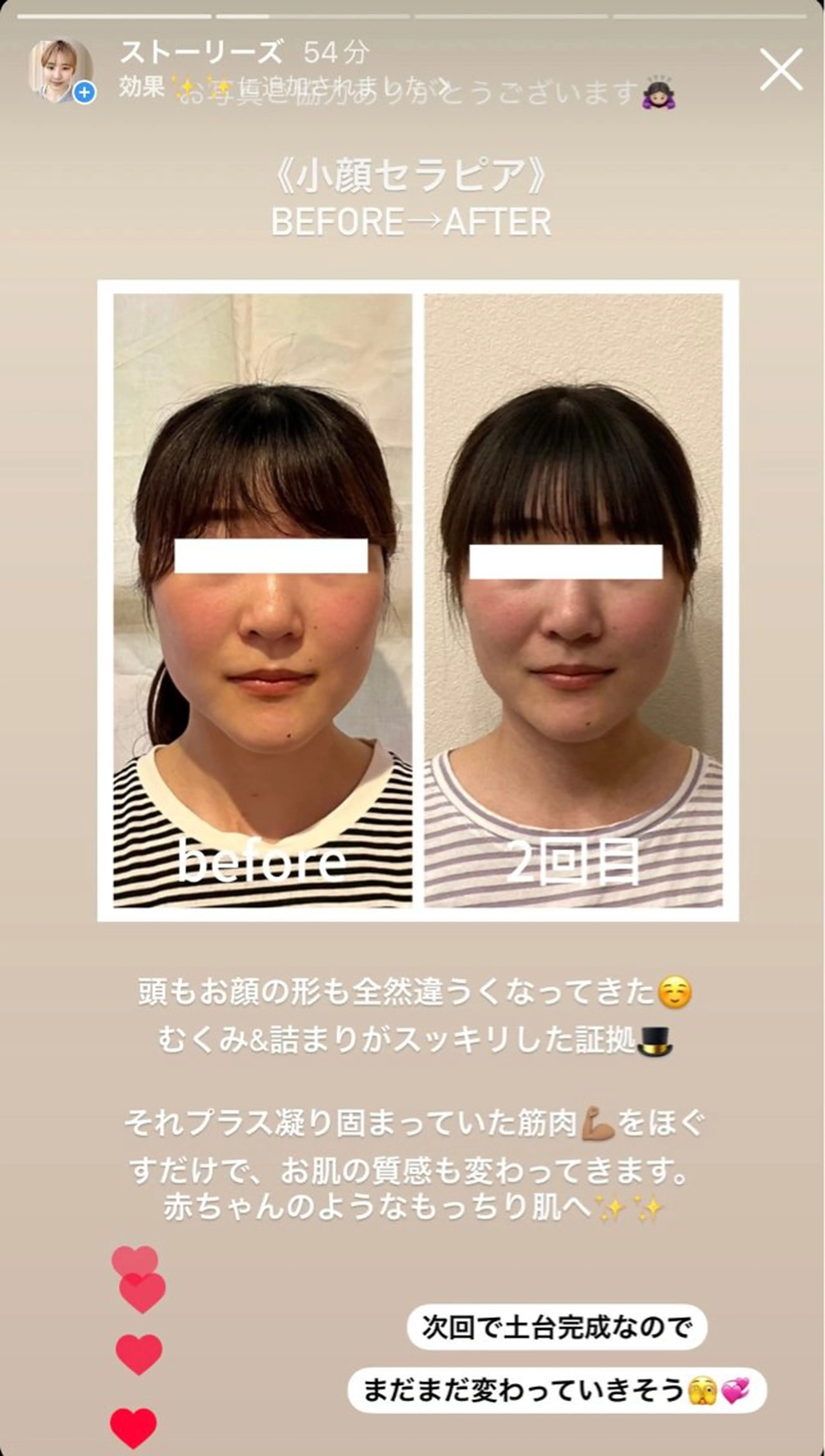 小顔サロン AMYONのエステ・リラクイメージ