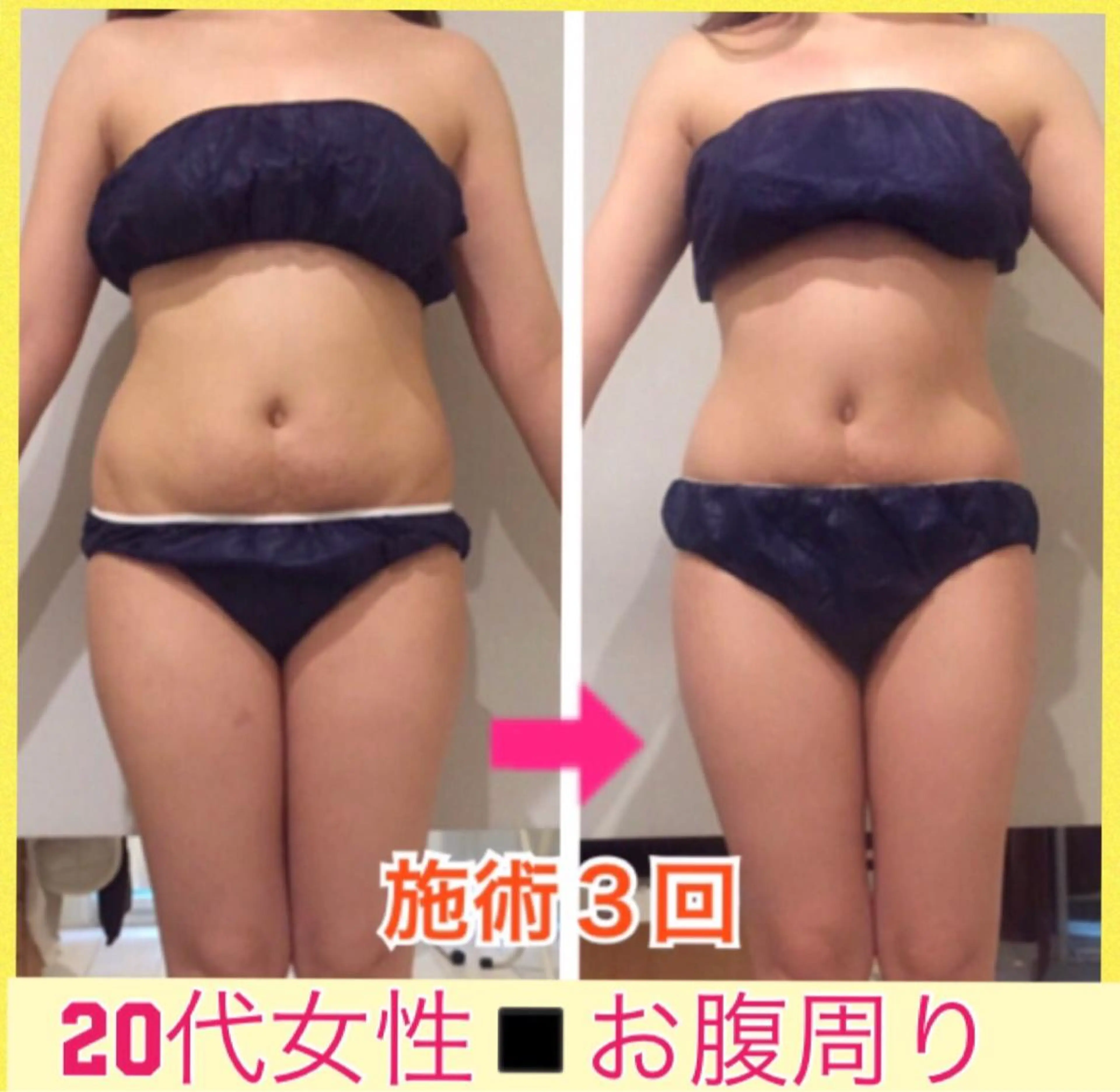 ショート カラー パーマ ヘアアレンジ メンズ キッズ ネイル マツエク・マツパ ‍痩身＆ボディ 結果出し🌟丹野のエステ・リラクイメージ