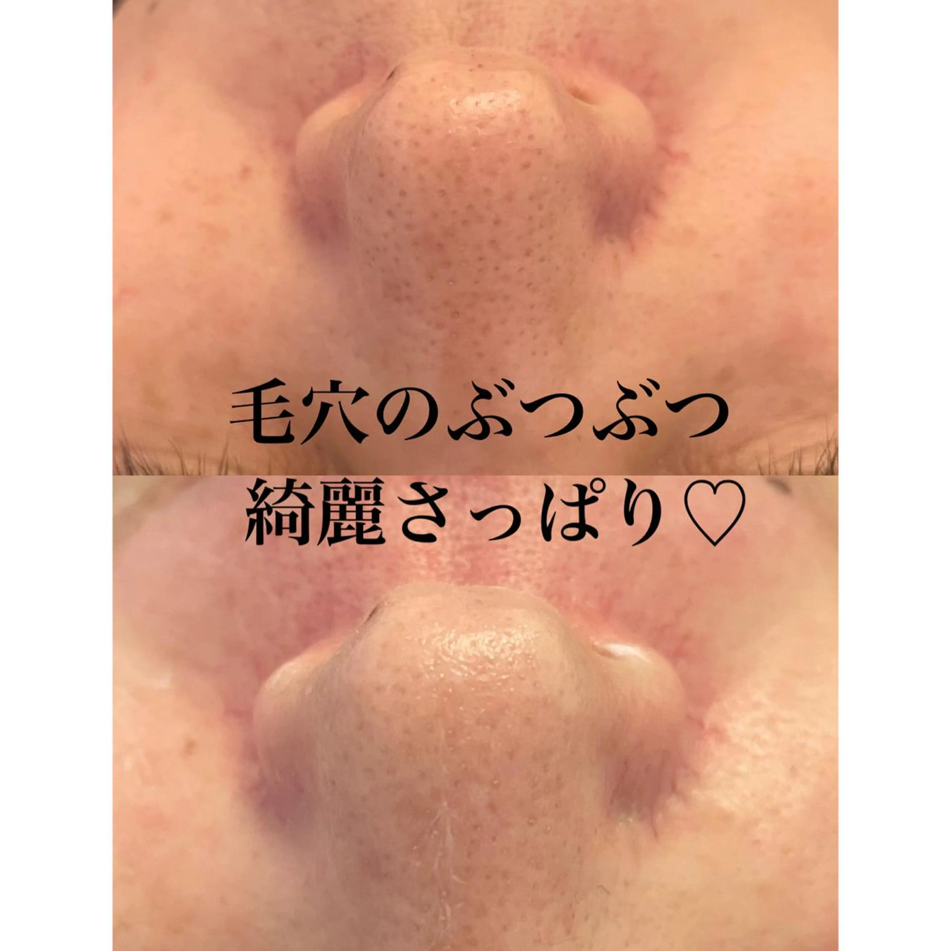 amu nail. RINAのネイルデザイン