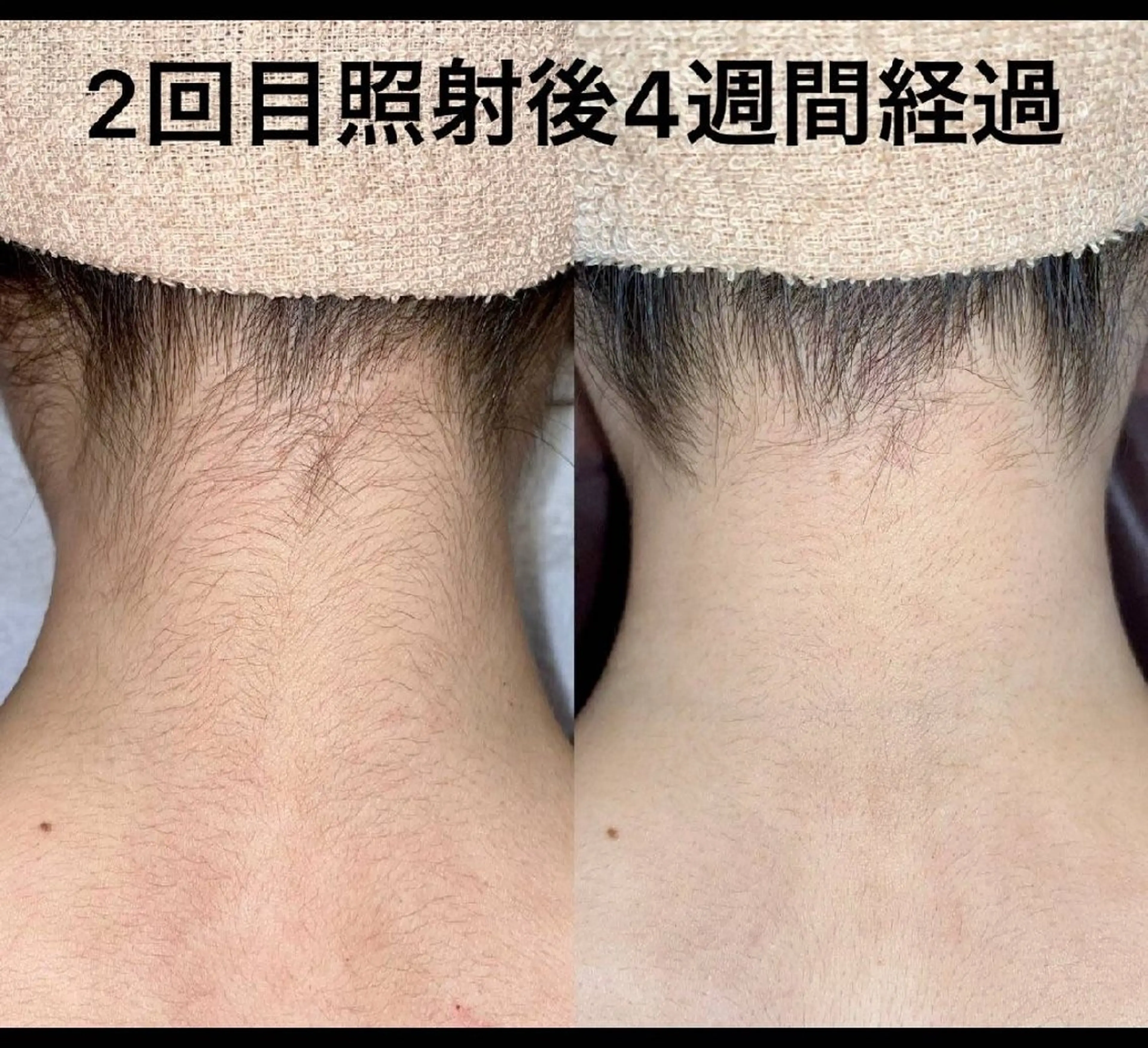 LOUISE.／脱毛所属・LOUISE. ／脱毛のエステ・リラクイメージ