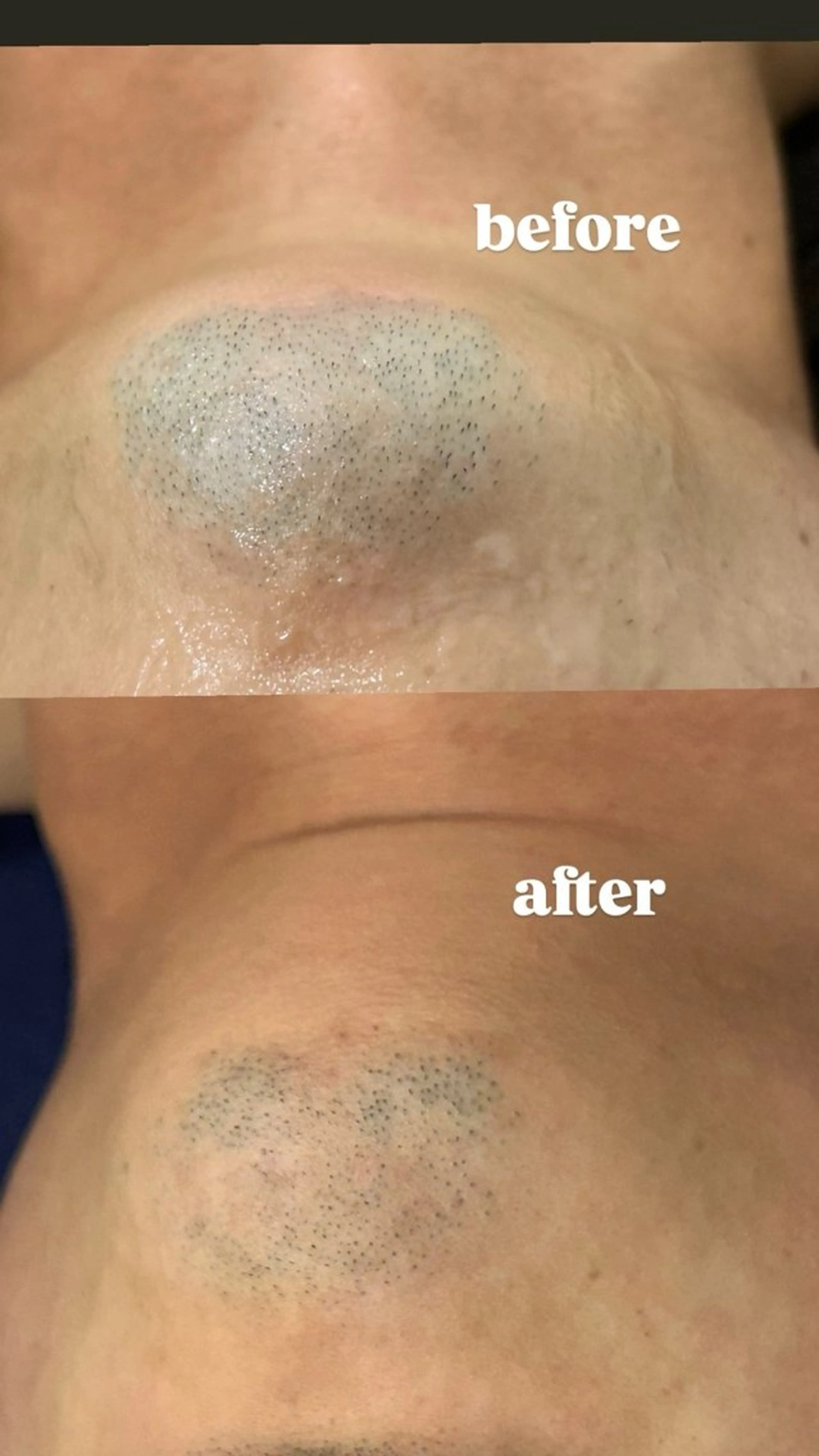 トータルビューティーサロンFirstclass所属・Firstclass Erikaのエステ・リラクイメージ