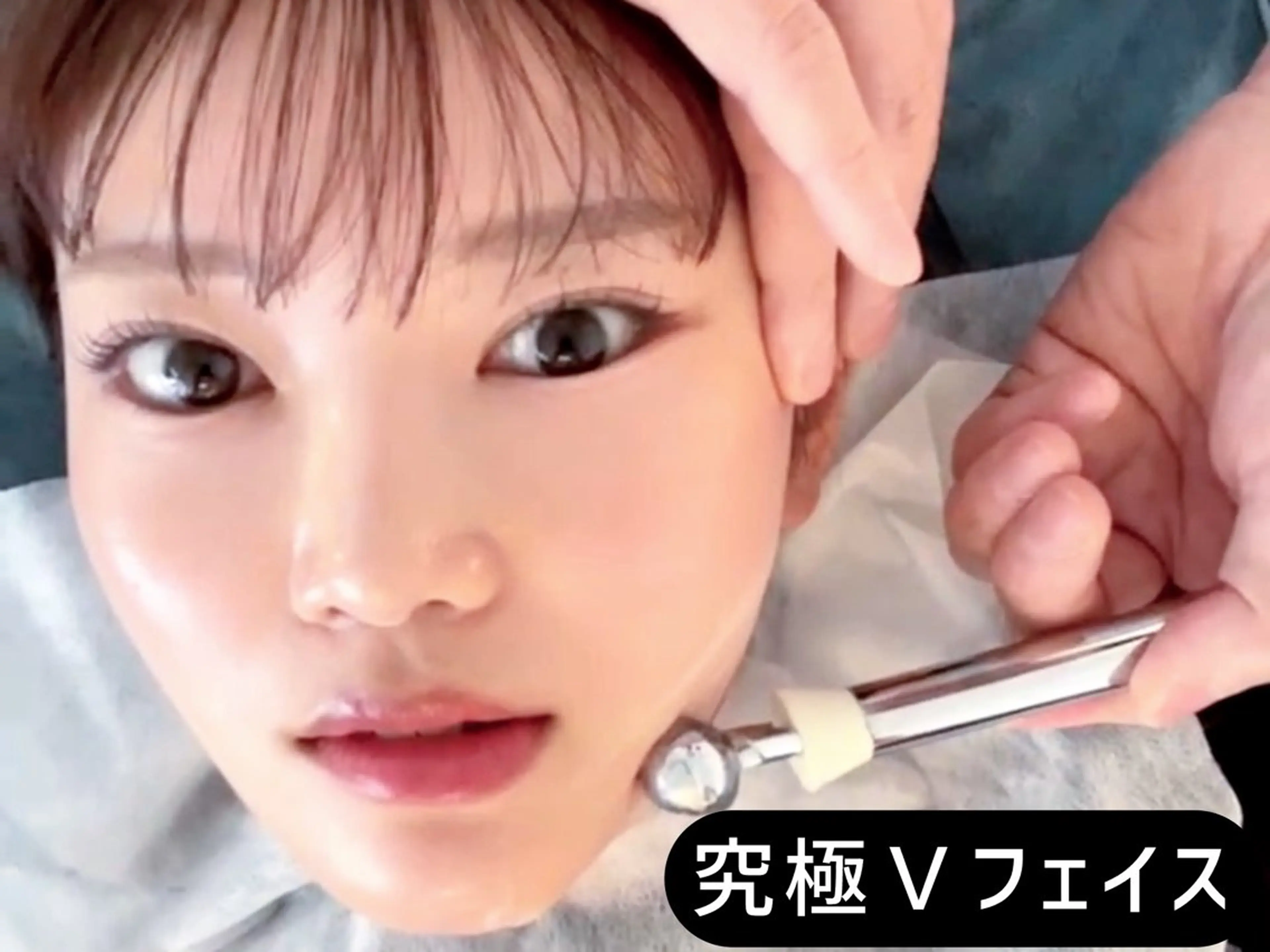 【横幅キュッ⚡】Vスティック×美容鍼EMS70分|エラ・頬もたつきの写真