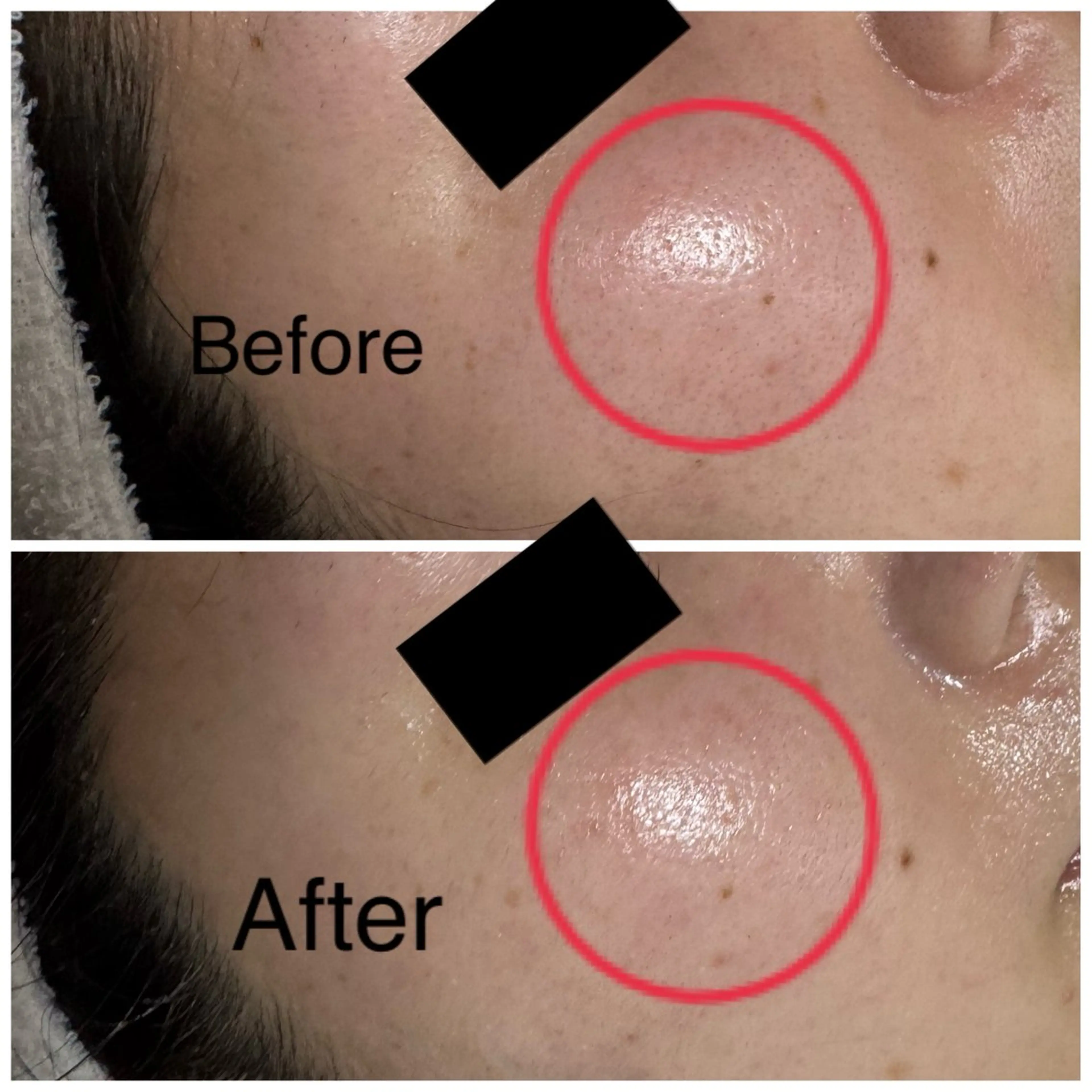 エステ ROR所属・ROR Nanaのネイルデザイン