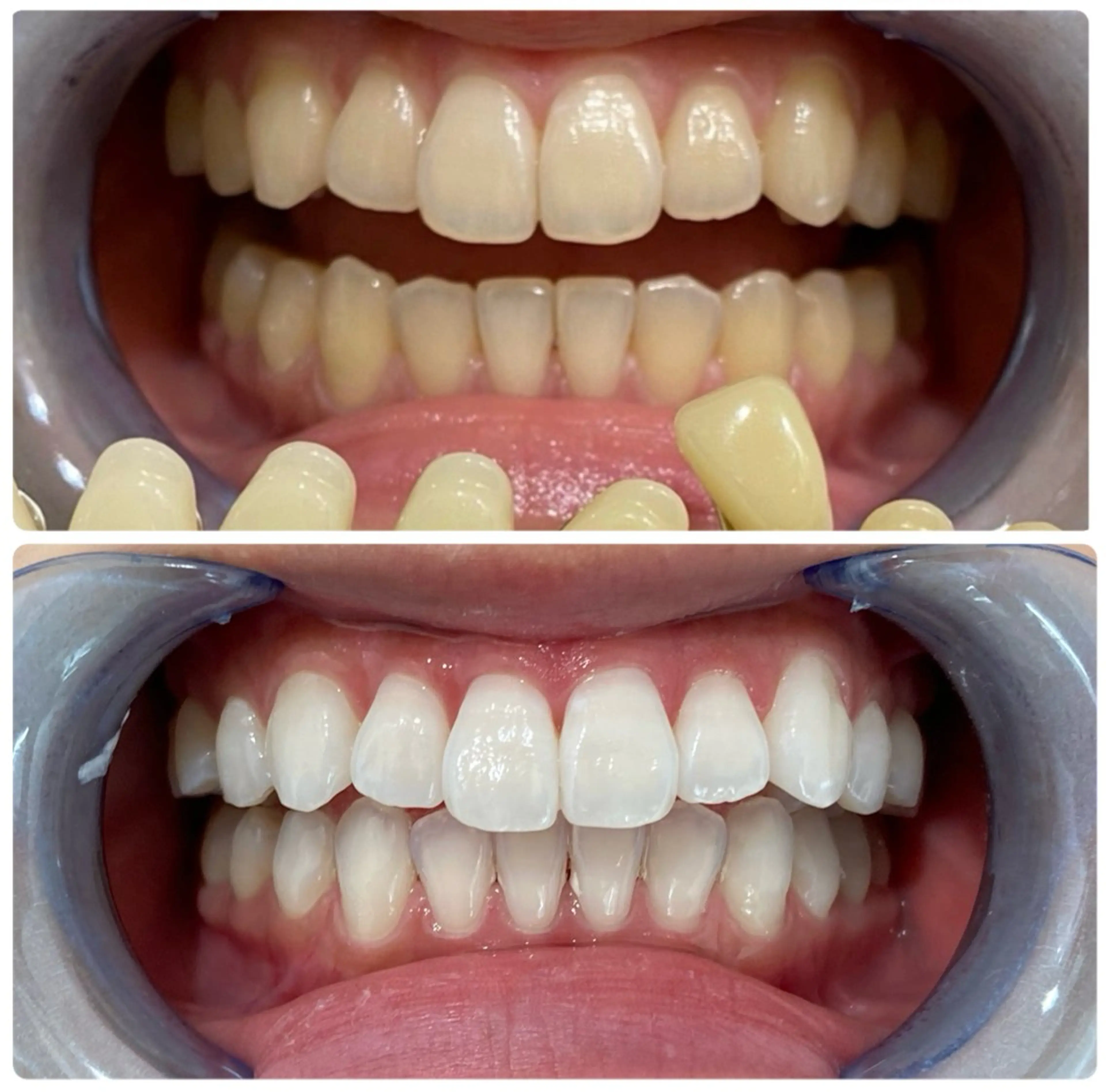 cona whitening神保町所属・ホワイトニング 神保町店/杉浦のエステ・リラクイメージ