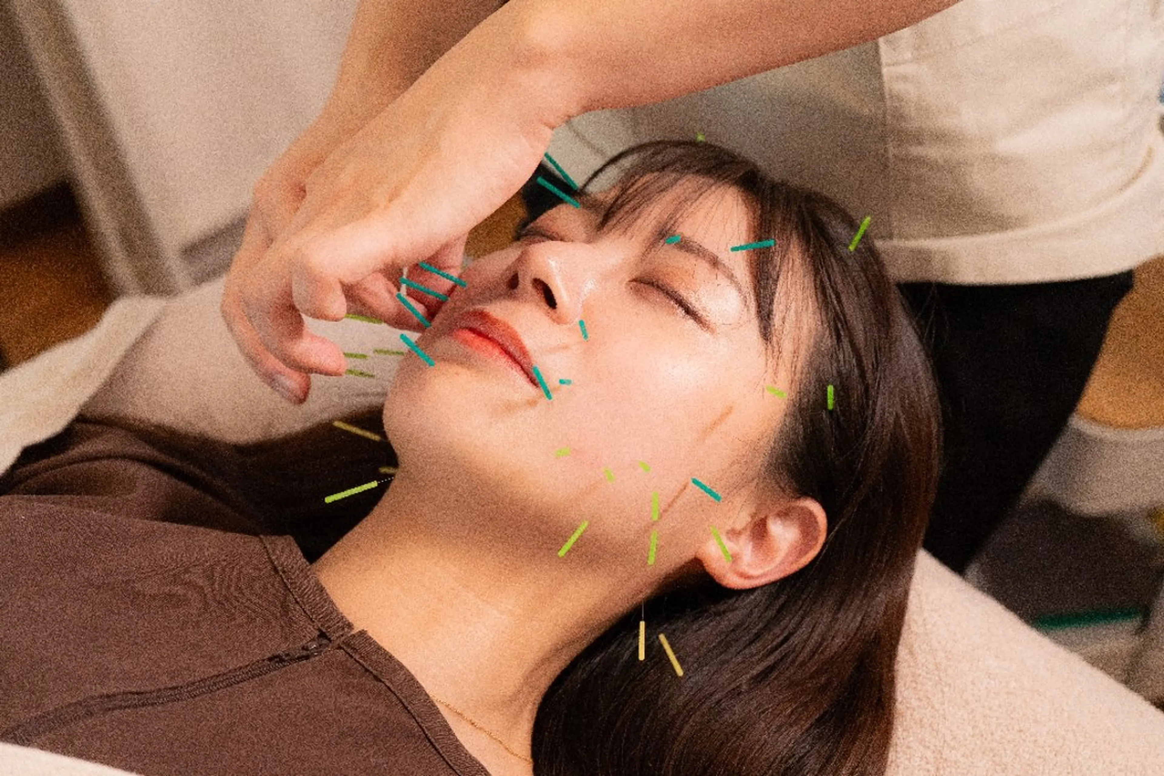 即効⚡小顔美容鍼🪡 むくみたるみ脂肪解消のエステ・リラクイメージ