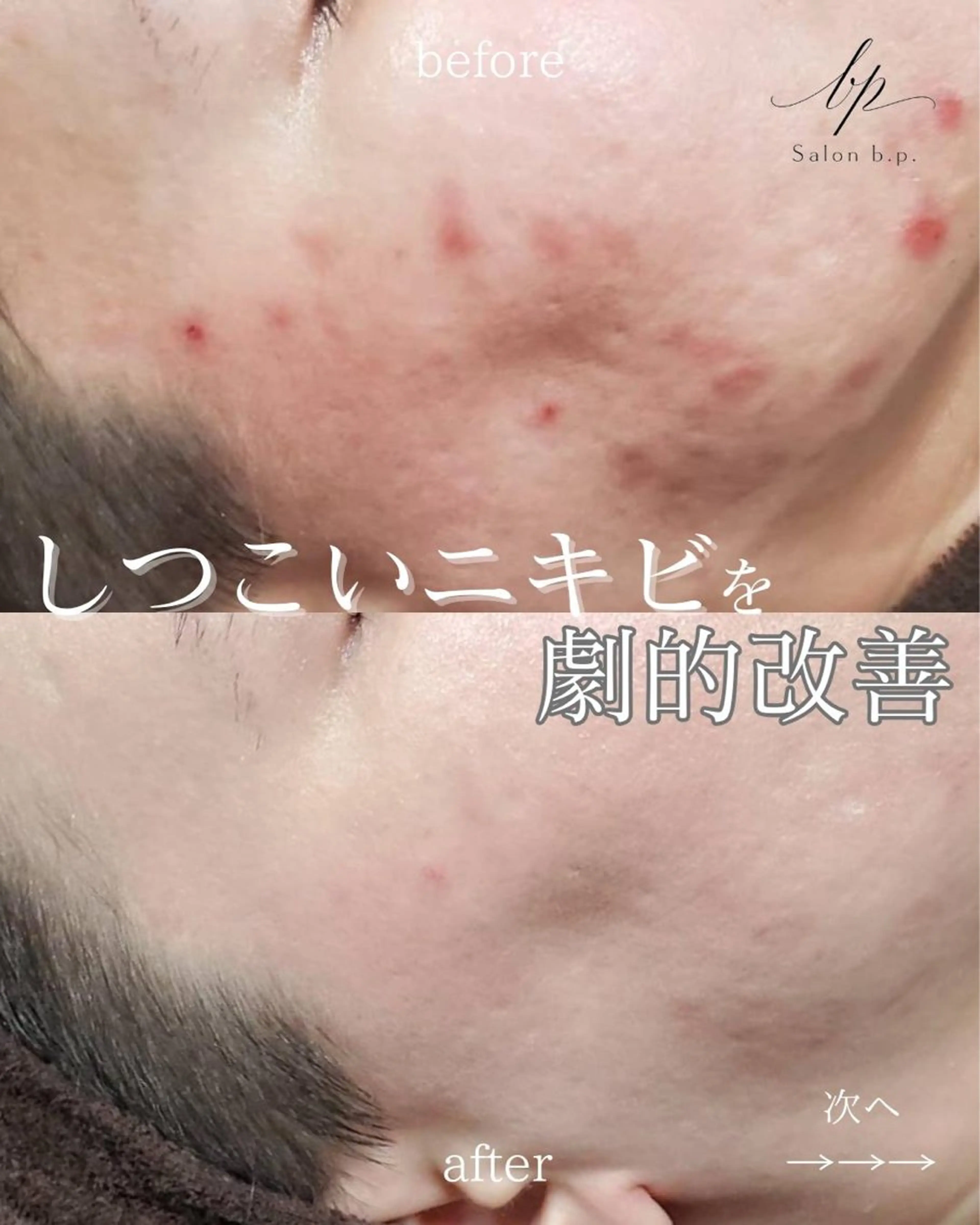 Salon b.p. 渋谷🤍Rinのエステ・リラクイメージ