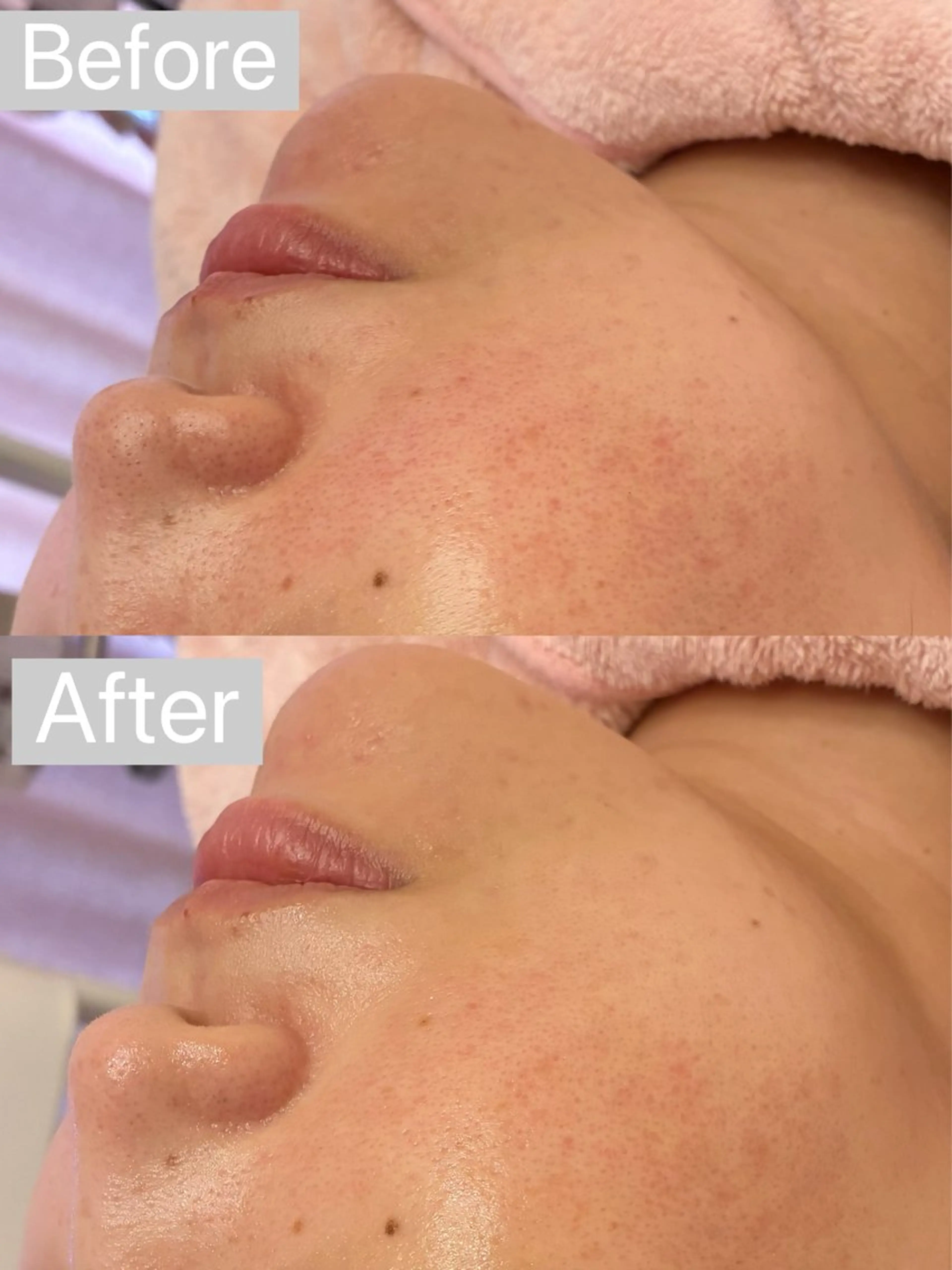 エステ アイラッシュ&エステサロンLinda西宮所属・小顔&毛穴・肌質改善 LINDA西宮 AIのエステ・リラクイメージ