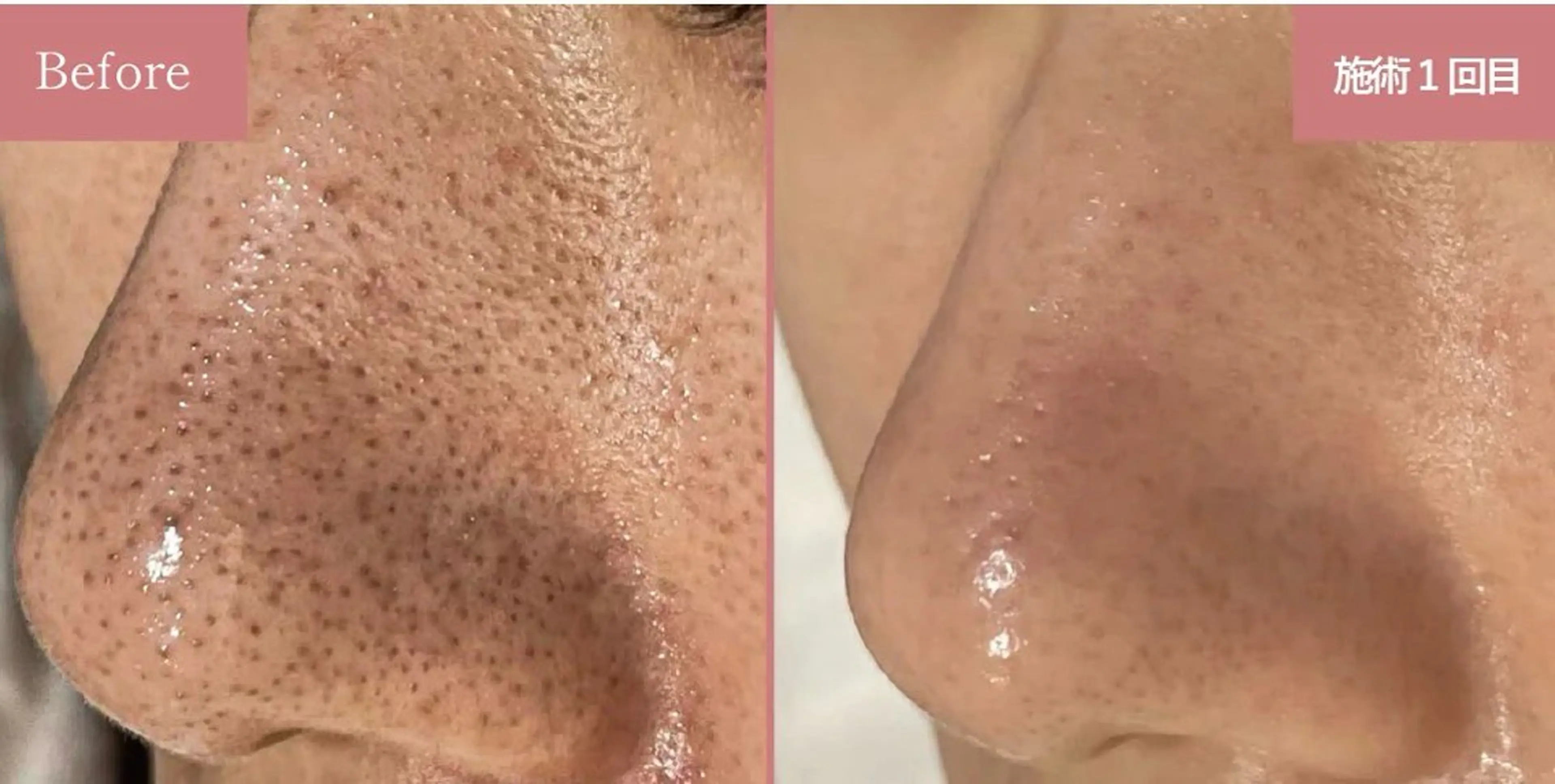 レイフィールド江南店所属・レイエステティック 江南店のエステ・リラクイメージ