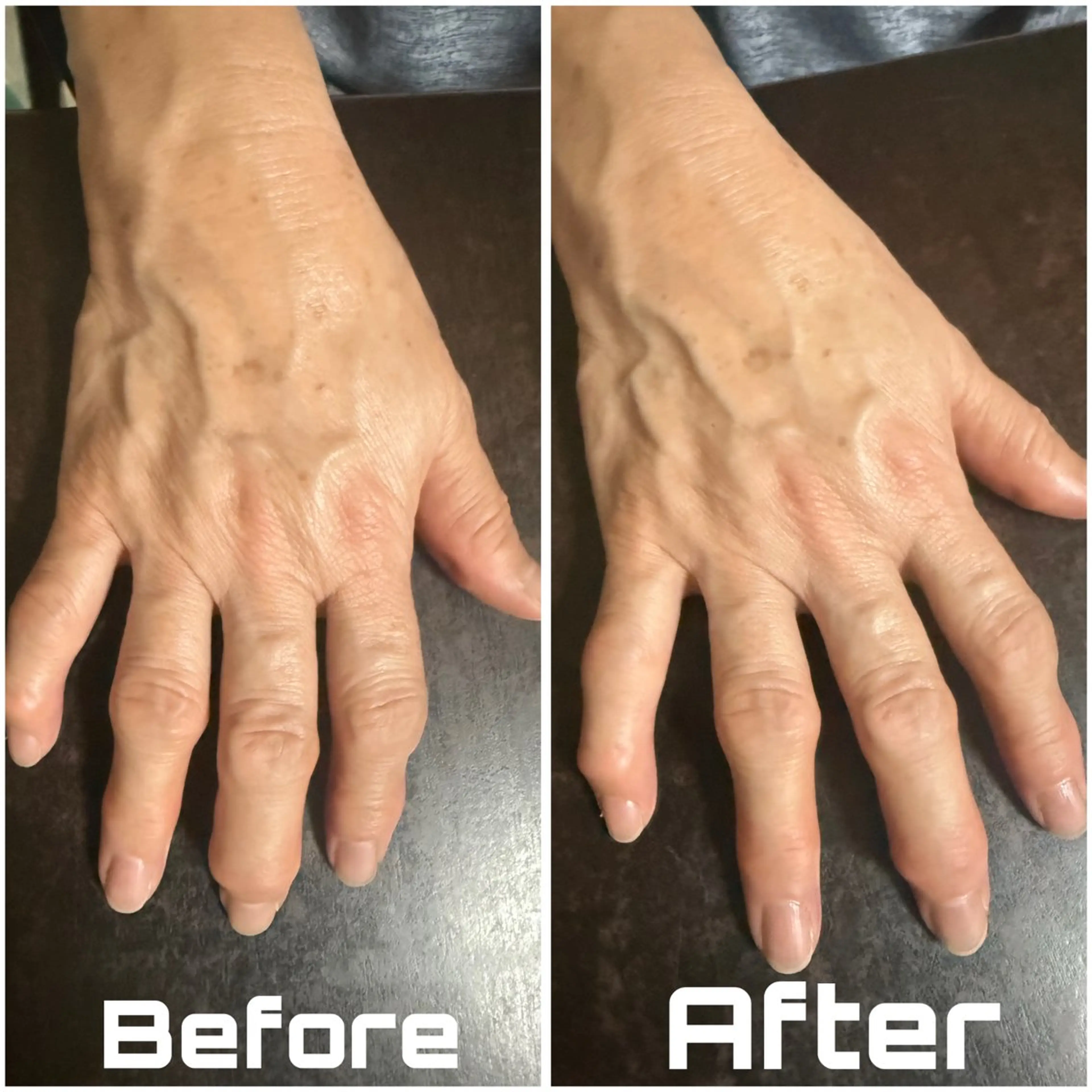 ハンドケア 【敏感肌管理×小顔サロン】Belle orchid所属・東三国/新大阪 敏感肌×小顔サロンのエステ・リラクイメージ