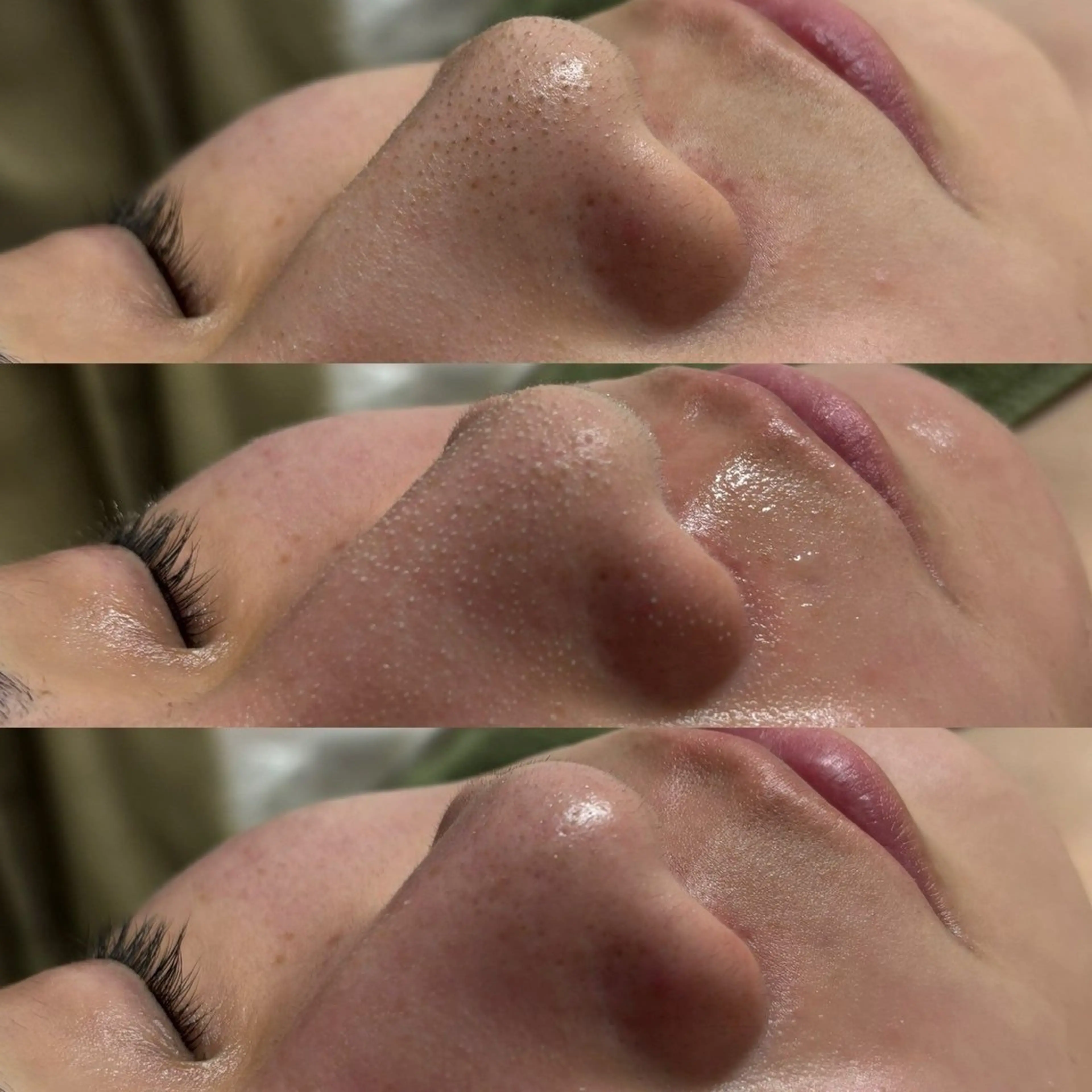 フェイシャル/脱毛 ジョアアンジェ竹田のエステ・リラクイメージ