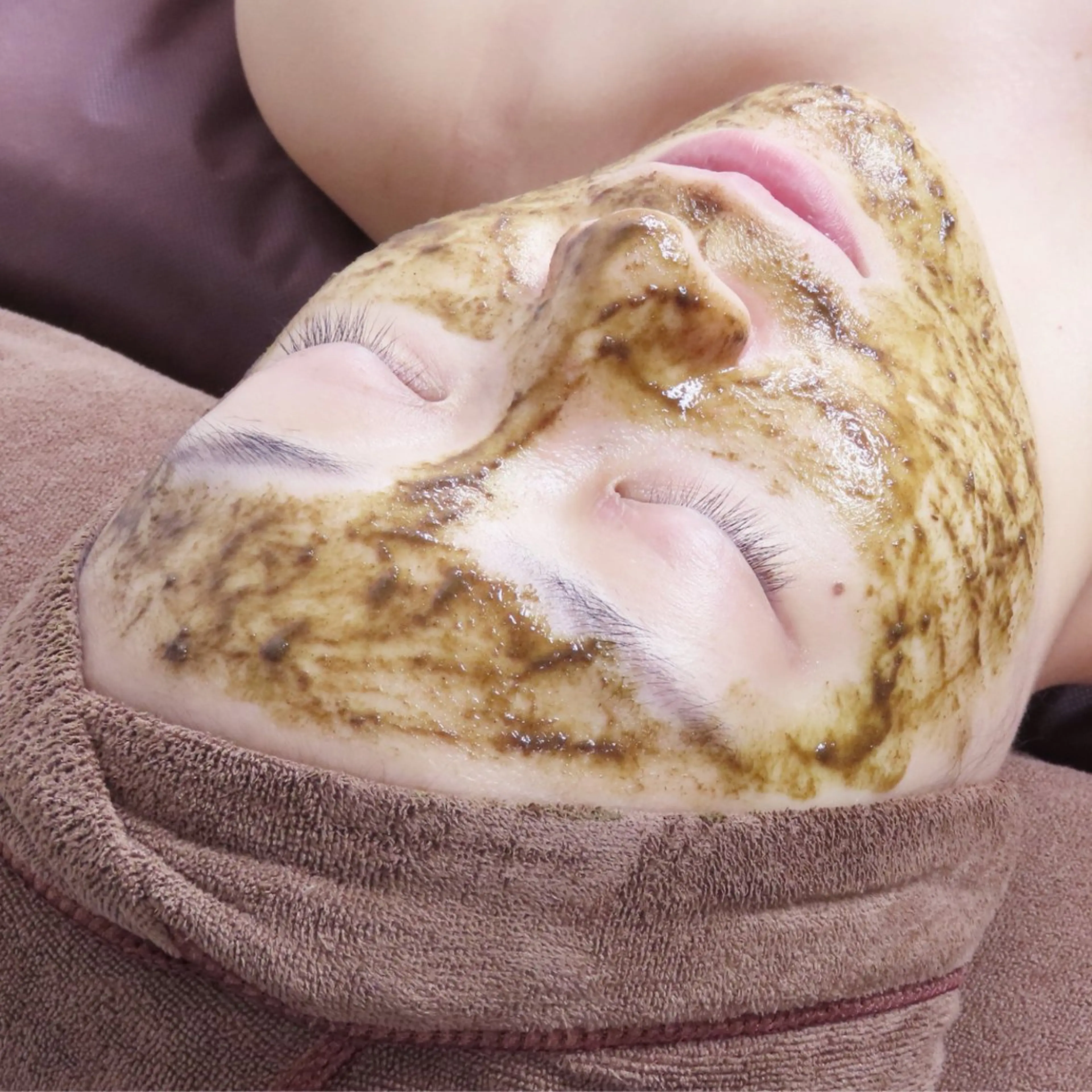 初回【ニキビケア】剥かない顔ハーブピーリング/ヘッド付★60分の写真