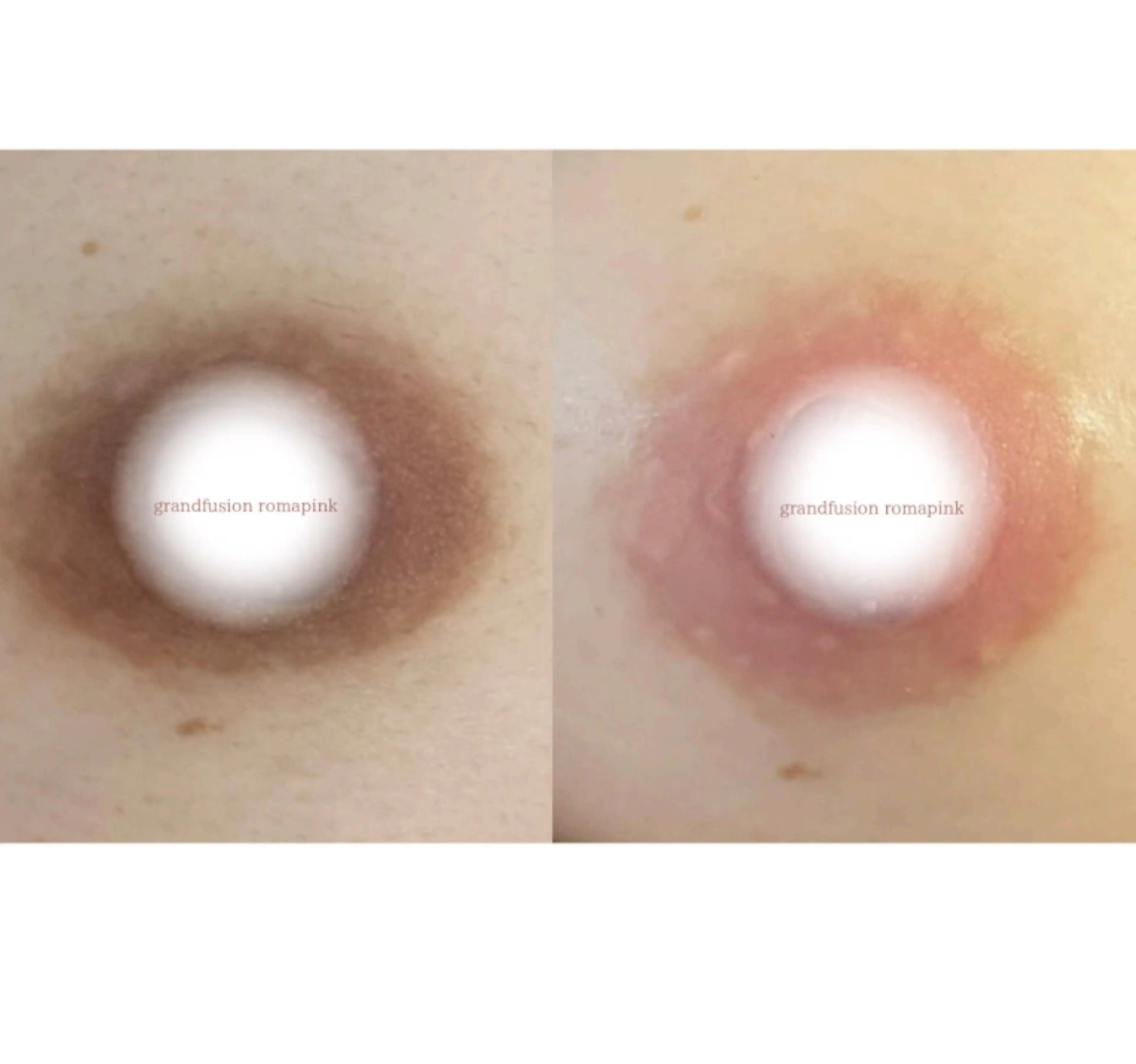 女性のお悩み美容 サロン　ヴィーナスのエステ・リラクイメージ