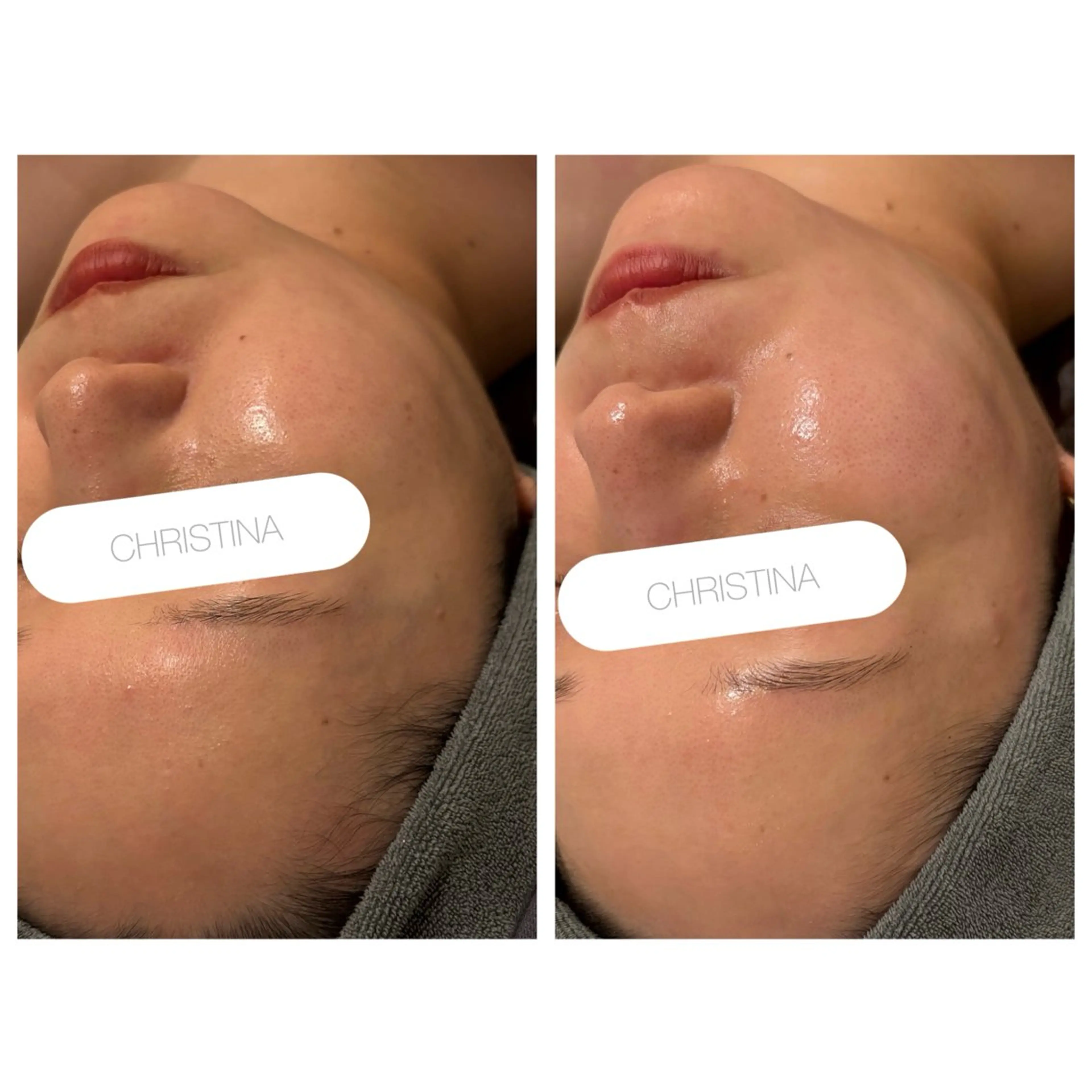 小顔コルギ ☆表参道/外苑前のエステ・リラクイメージ