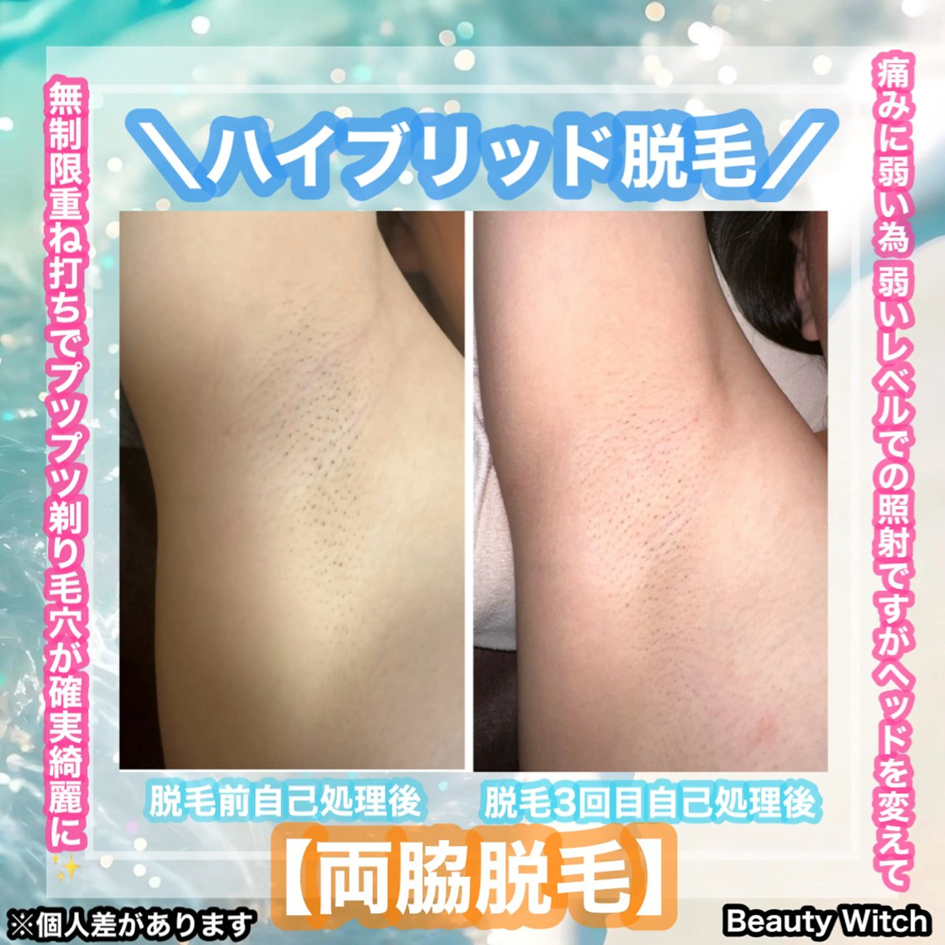 脱毛 痩身/脱毛/ネイル HARUKAのエステ・リラクイメージ