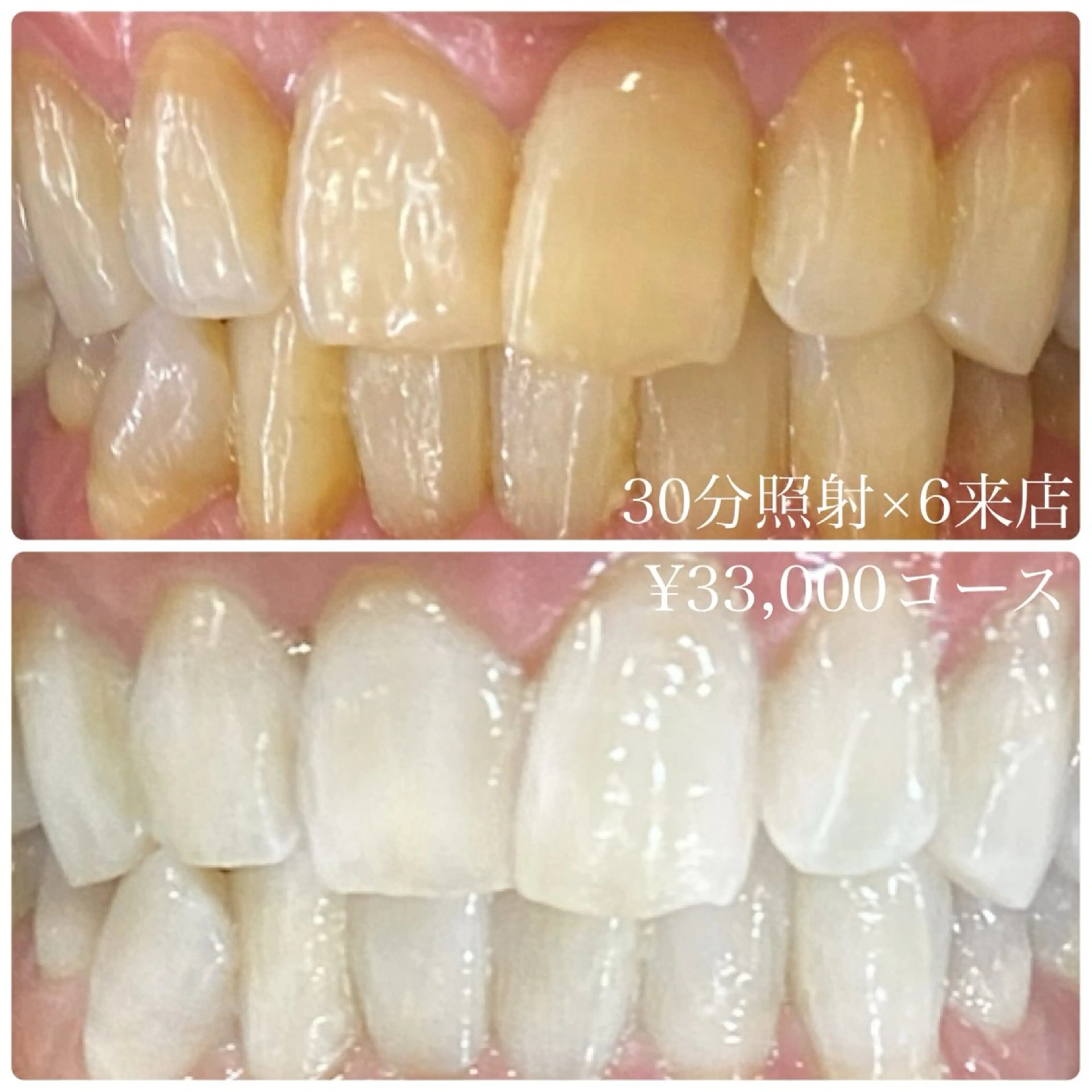 メンズ その他 ホワイトニングルーム　川崎店所属・ホワイトニング ルーム　川崎店のその他イメージ