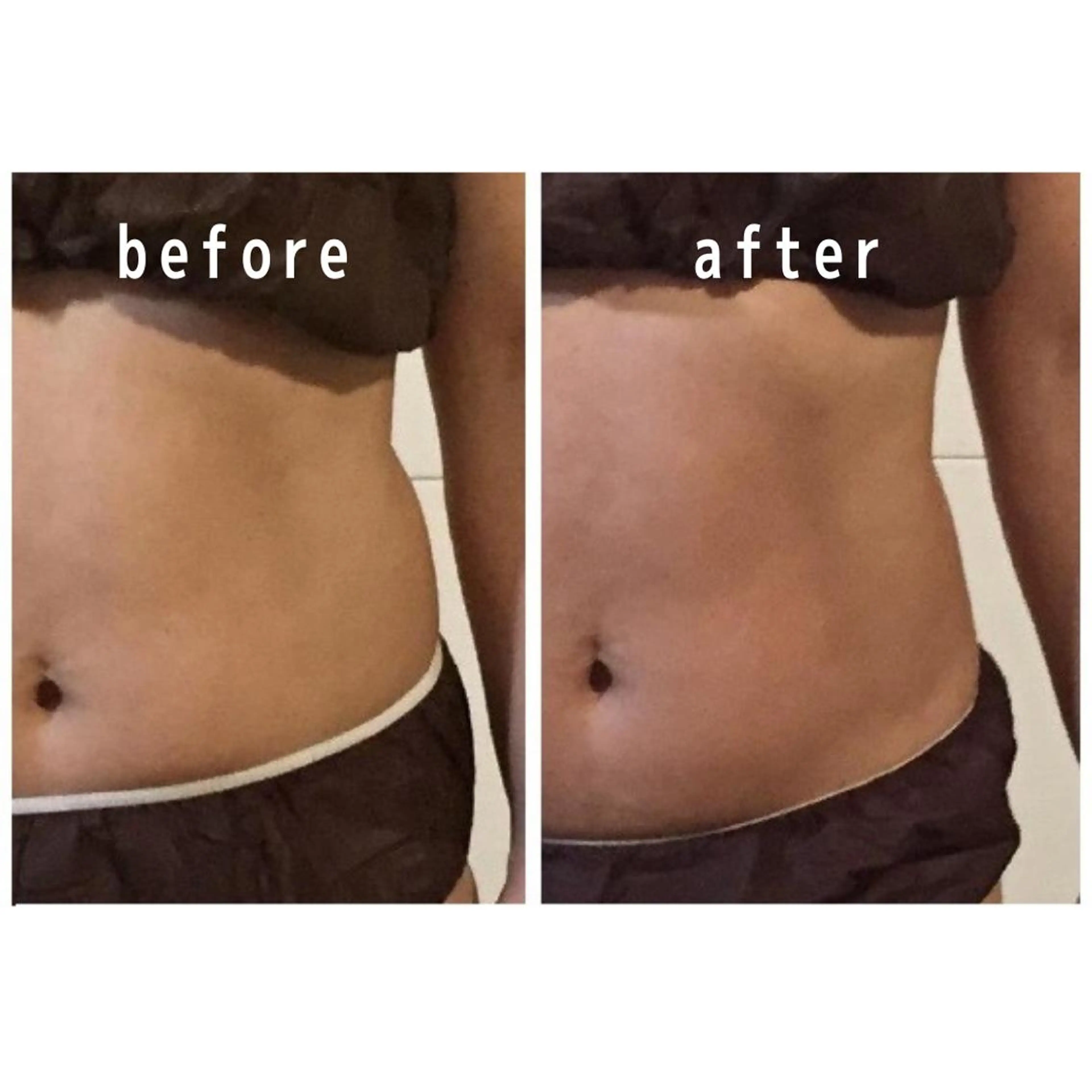 エステ リラク body make salon aqua所属・深層リンパ aquaのエステ・リラクイメージ