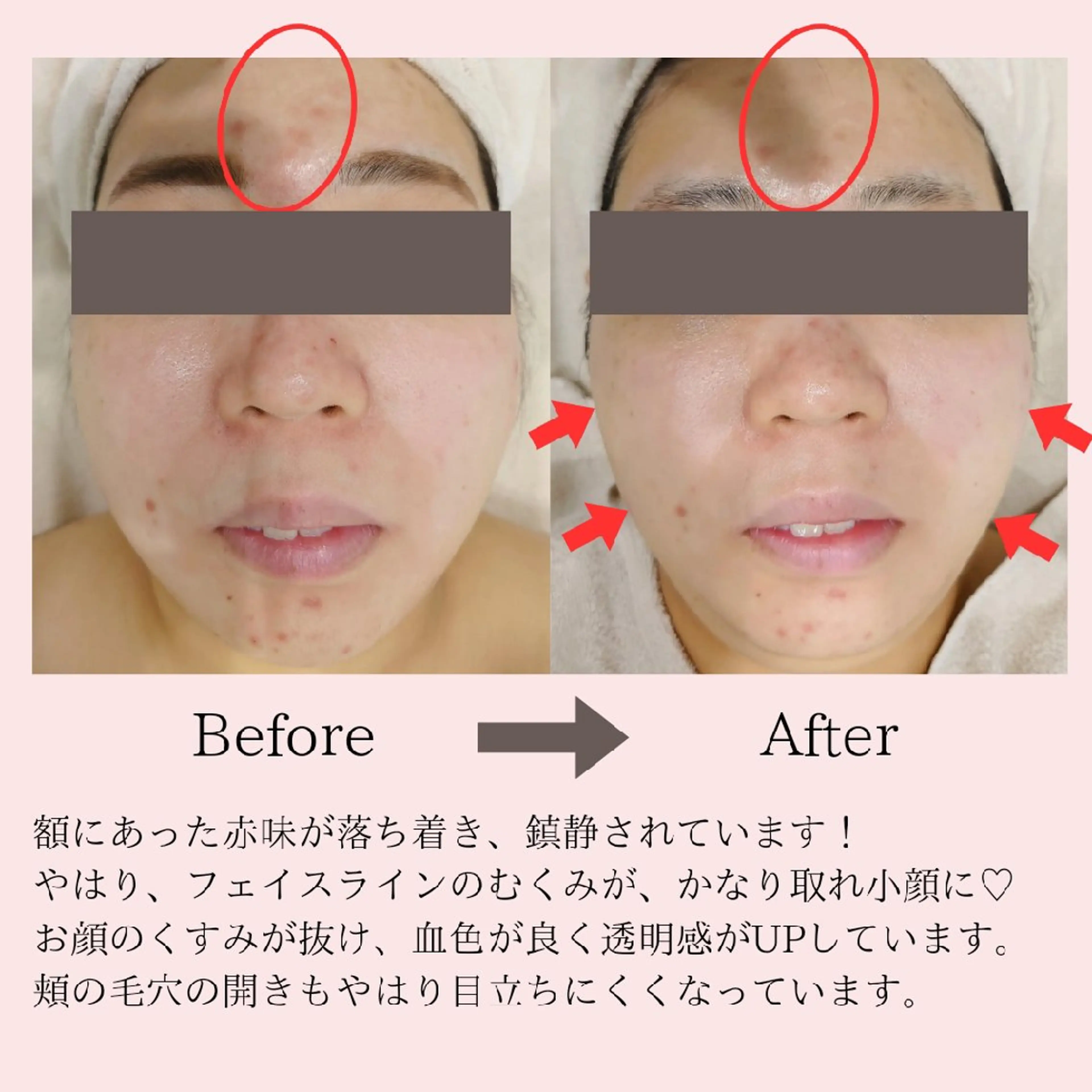 エステ PRETTIEST SHINE所属・フェイシャル/ボディ /ブライダル山田浩子のエステ・リラクイメージ