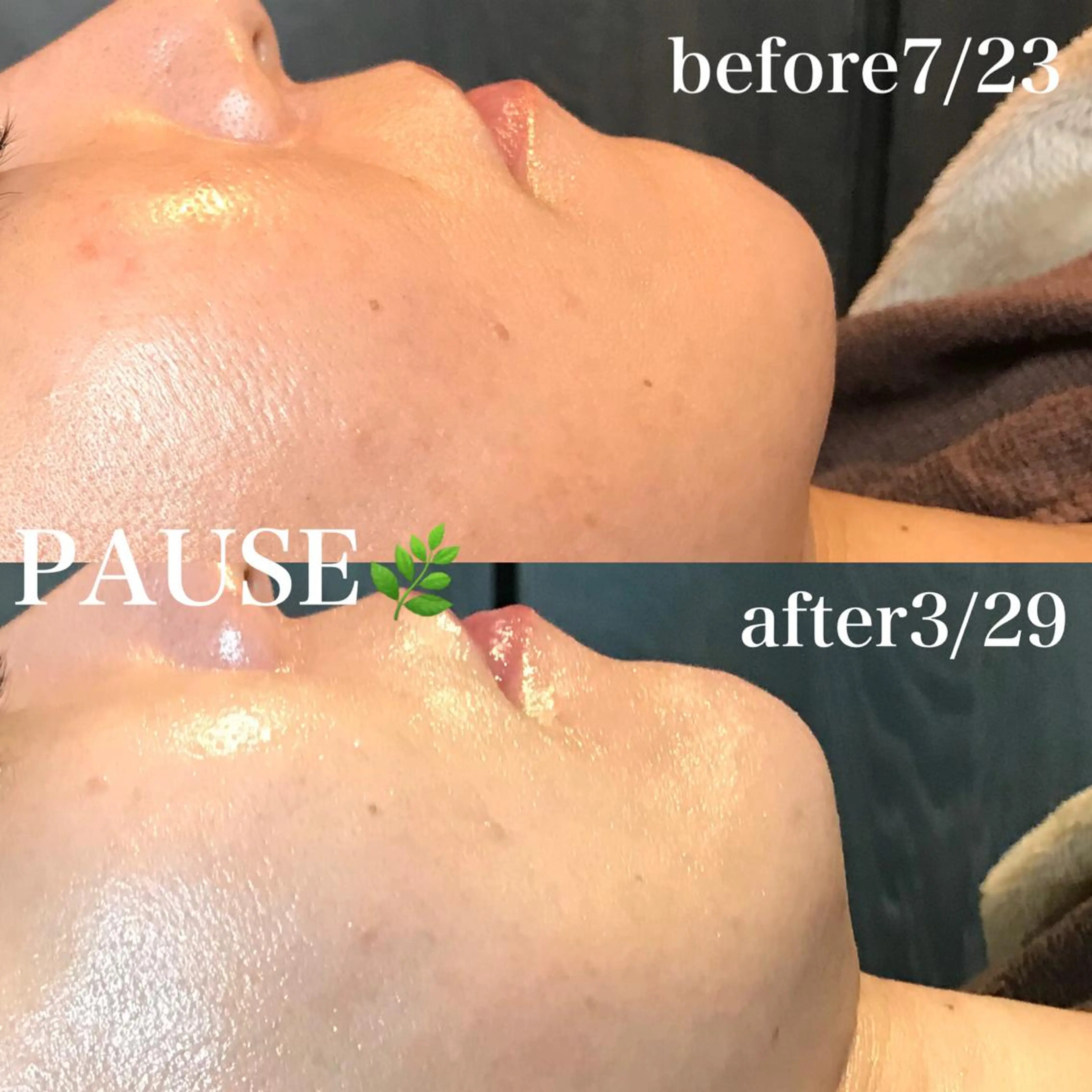 エステ 浜野 恵美のエステ・リラクイメージ