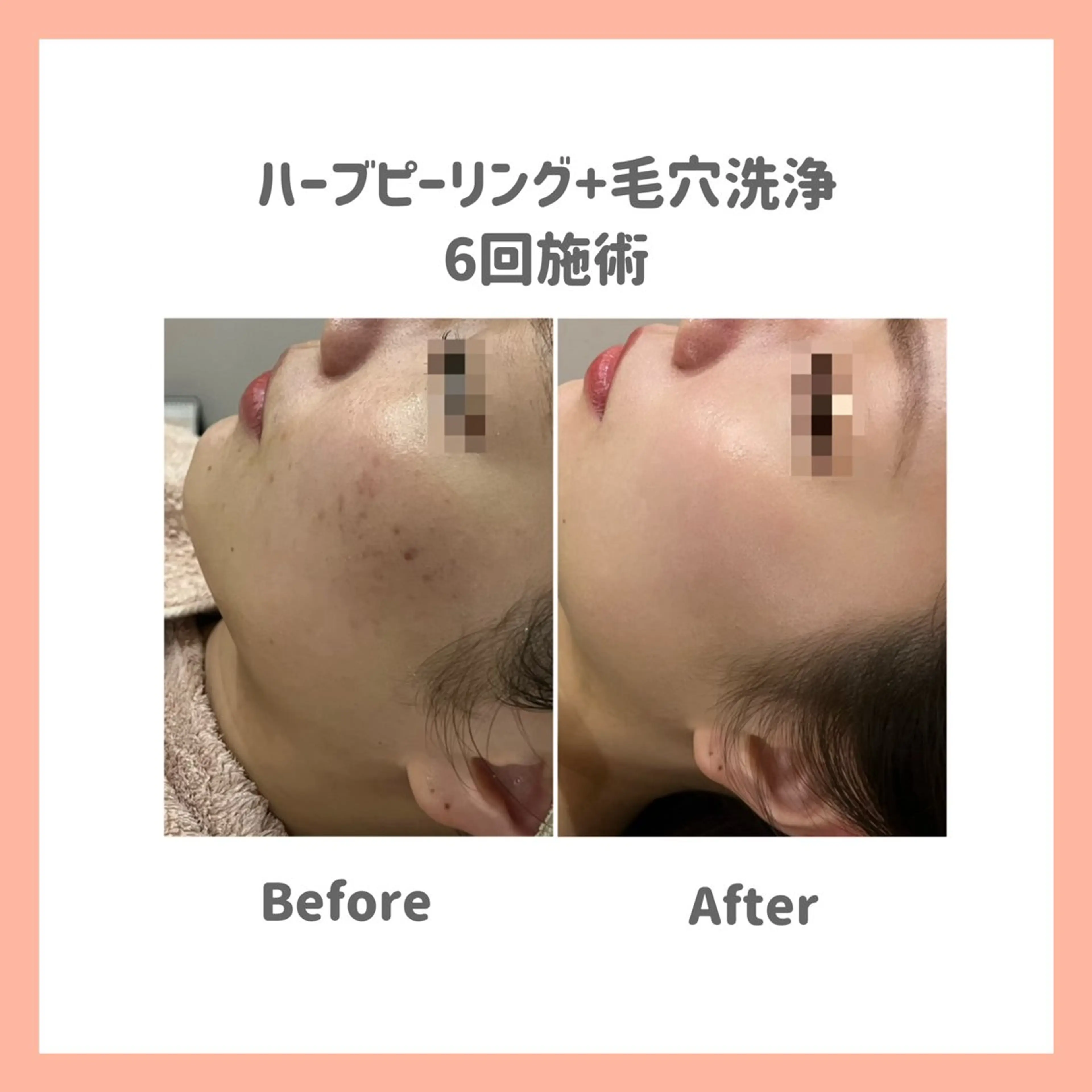 ハーブピーリング専門 muro.のエステ・リラクイメージ