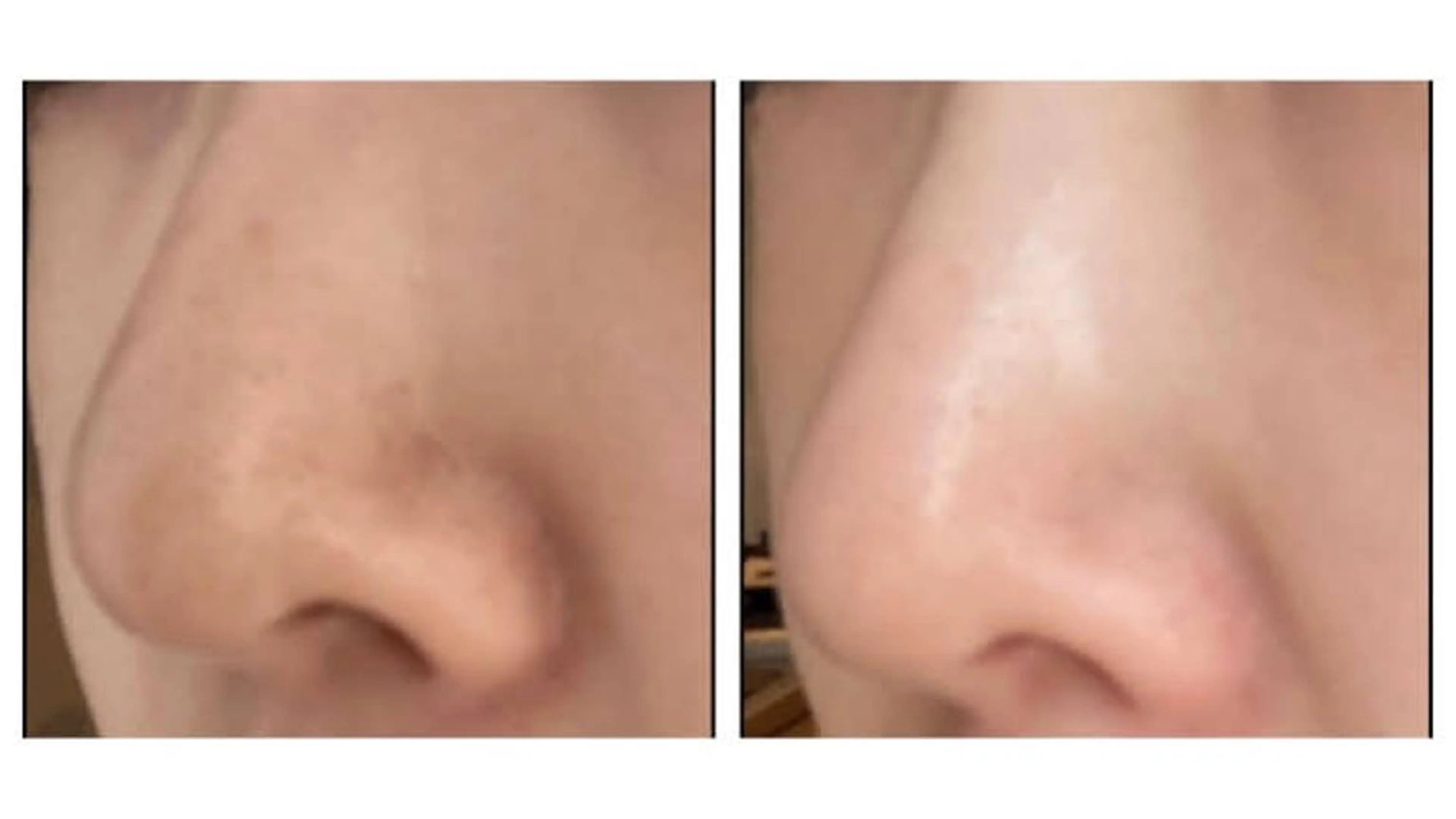 アリュールビューティー所属・エステ/痩身/リラク 🎀KOZUKAのエステ・リラクイメージ