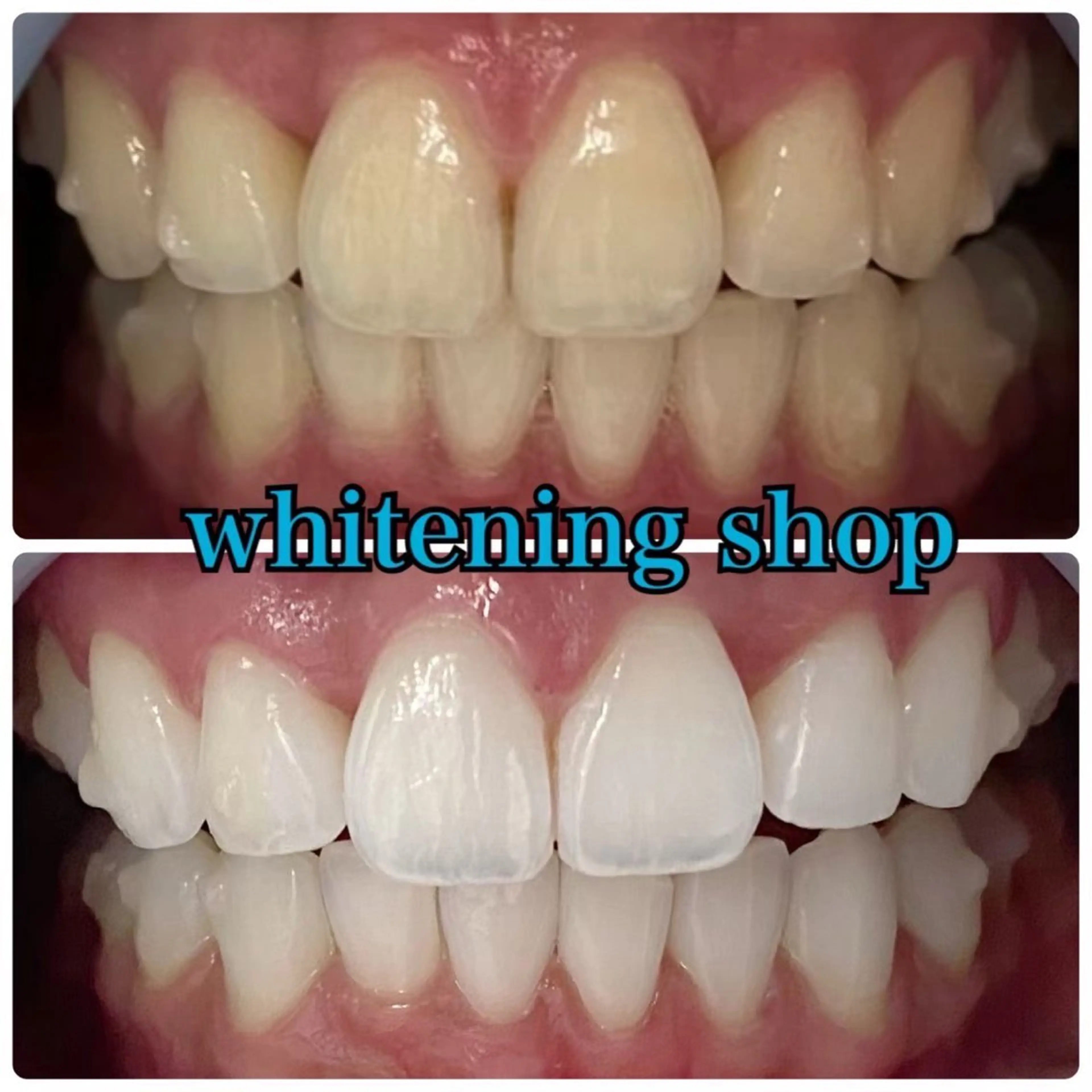 その他 ホワイトニングショップせんげん台店所属・スタッフ 兎洞のその他イメージ