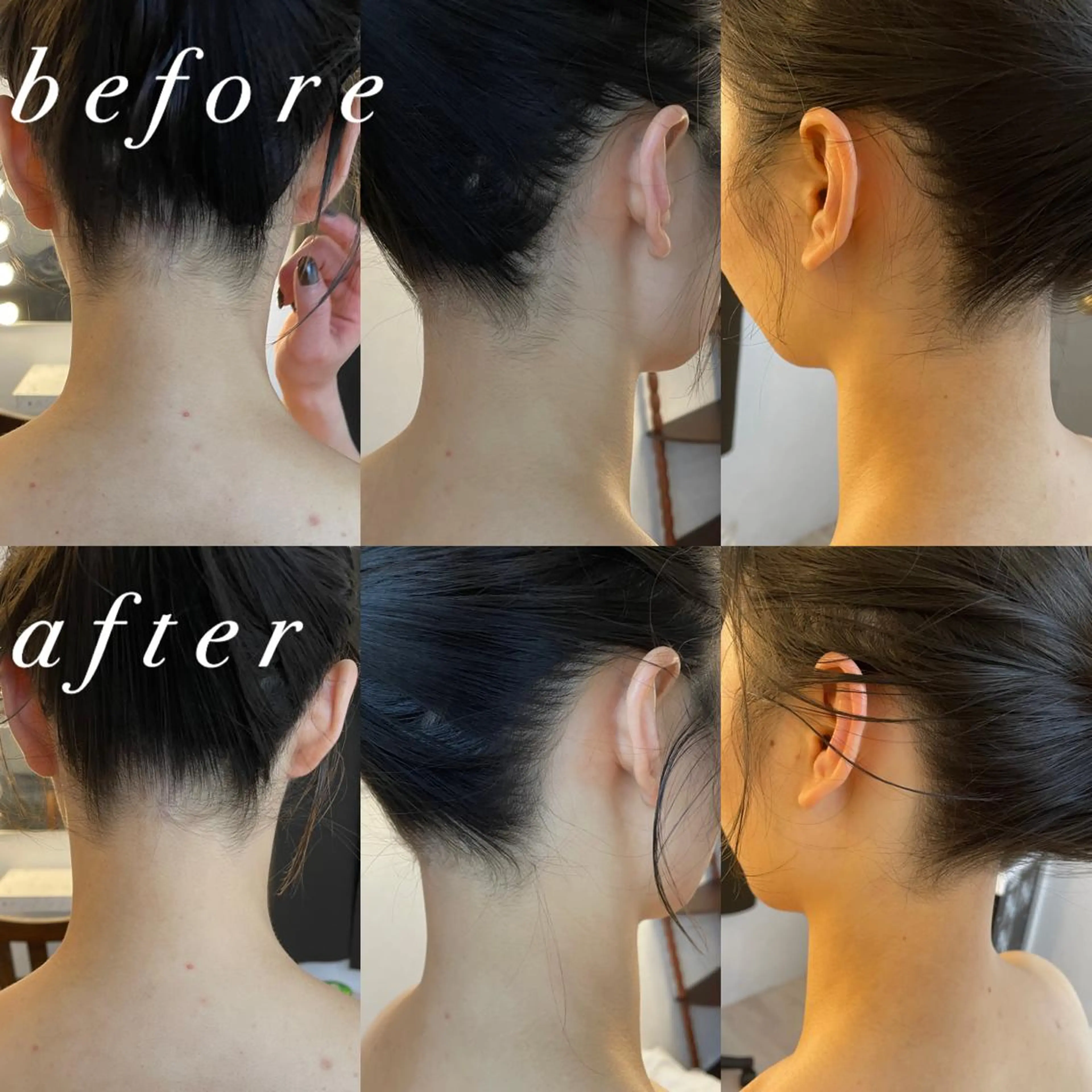 うなじ脱毛/美肌脱毛 LABELのエステ・リラクイメージ