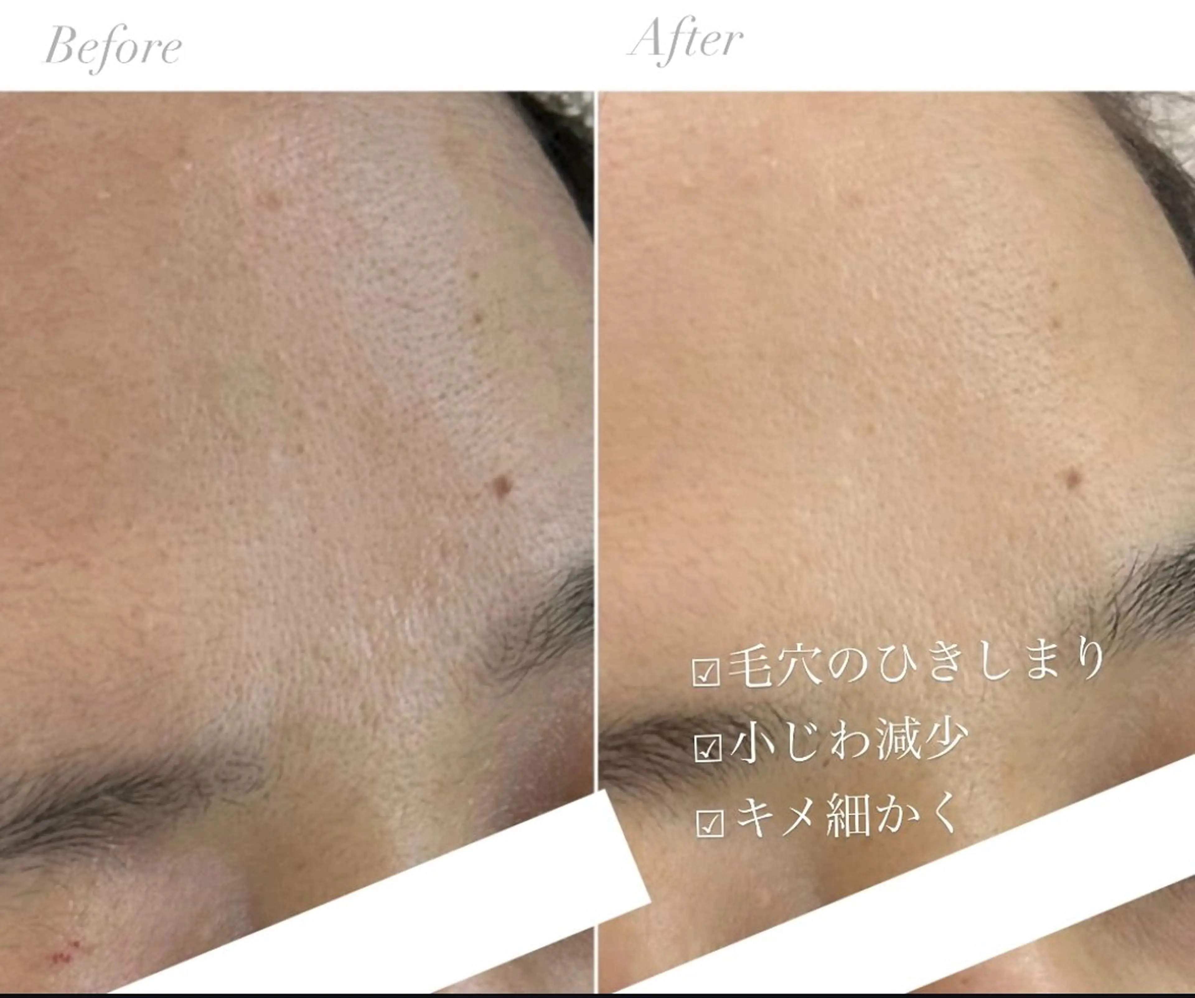 エステ 美肌育成専門サロンラクシュミー所属・毛穴肌管理サロン ラクシュミーのエステ・リラクイメージ