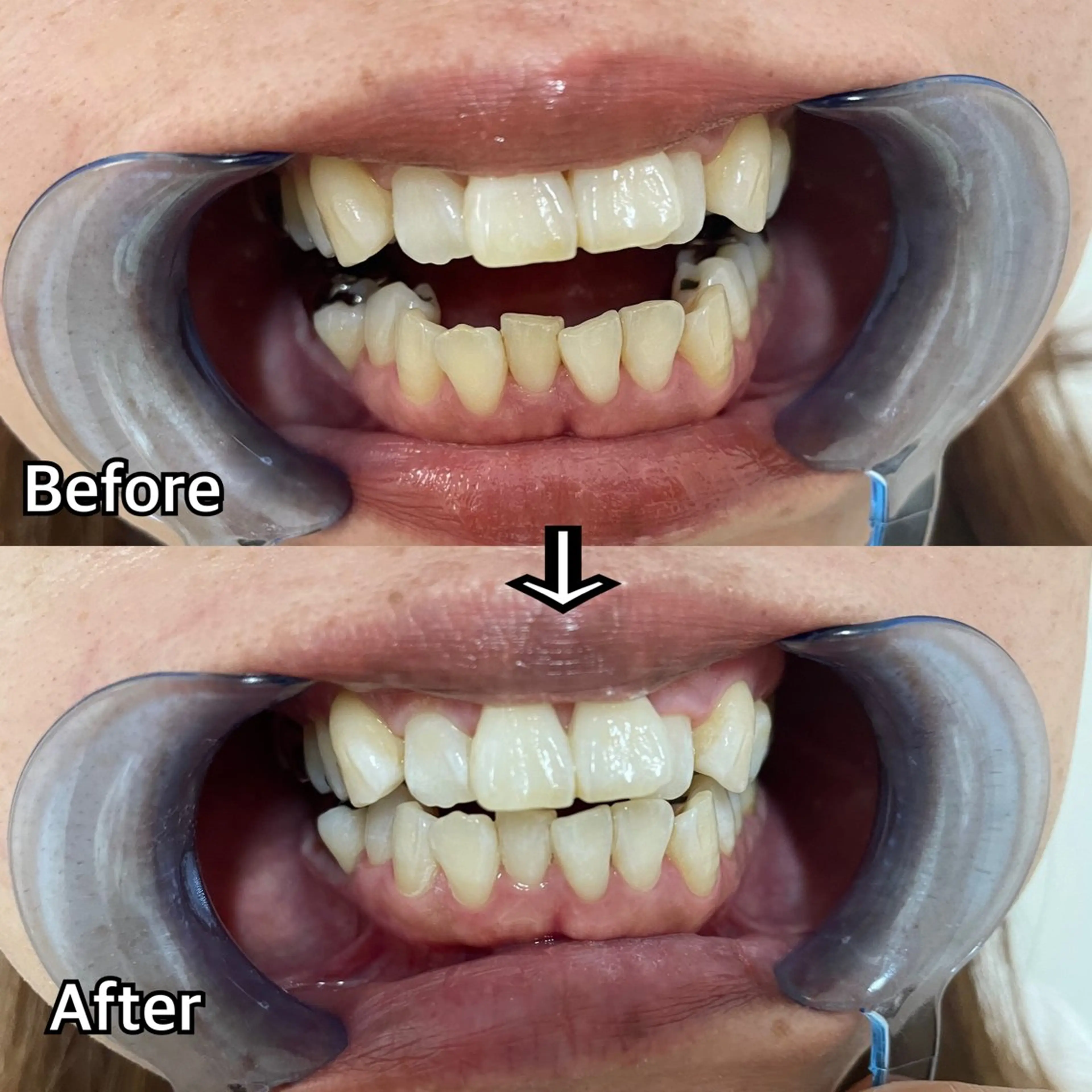 西宮ホワイトニング Kirarie所属・志水 有美のエステ・リラクイメージ