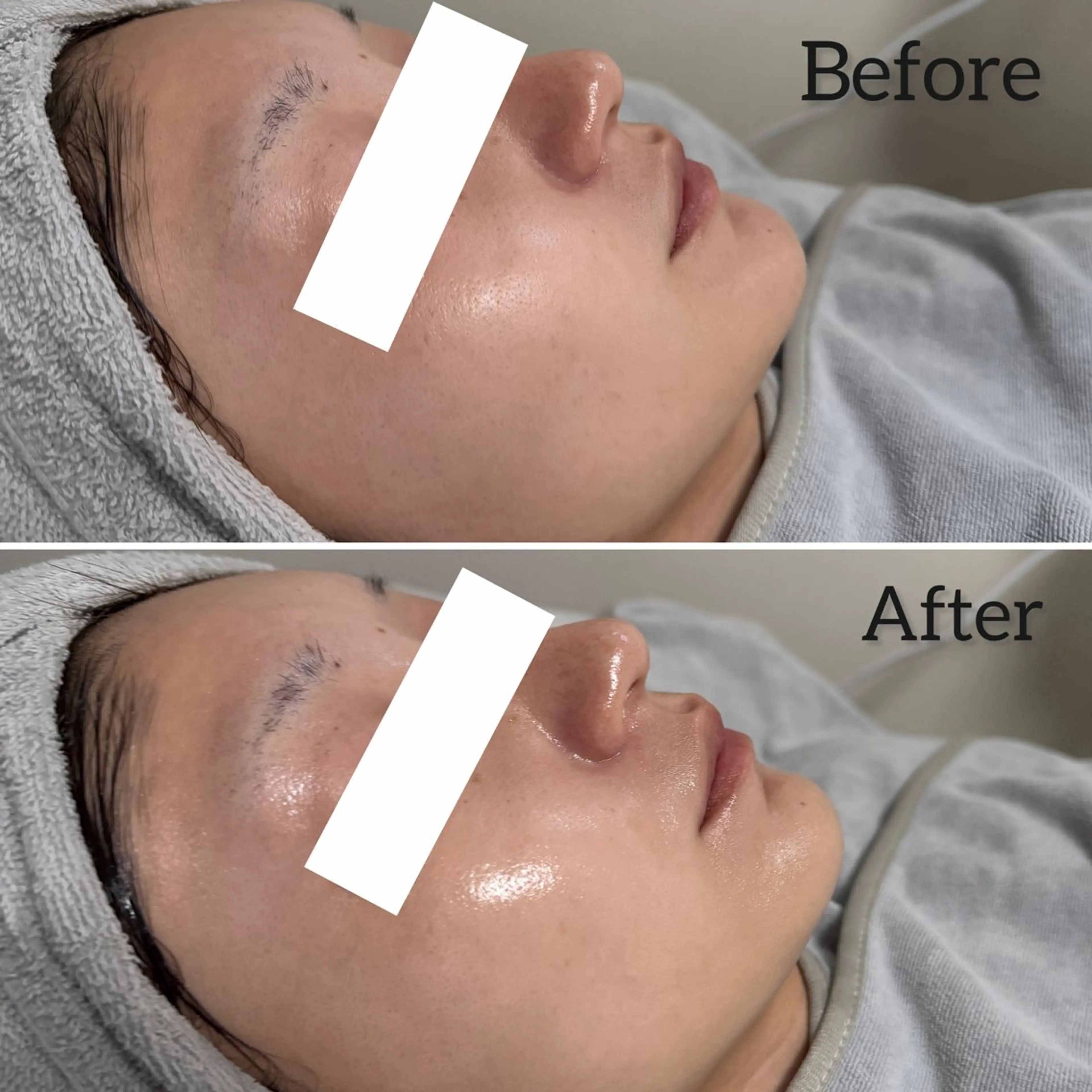 エステ Éclat de Belle🫧白玉肌のその他イメージ